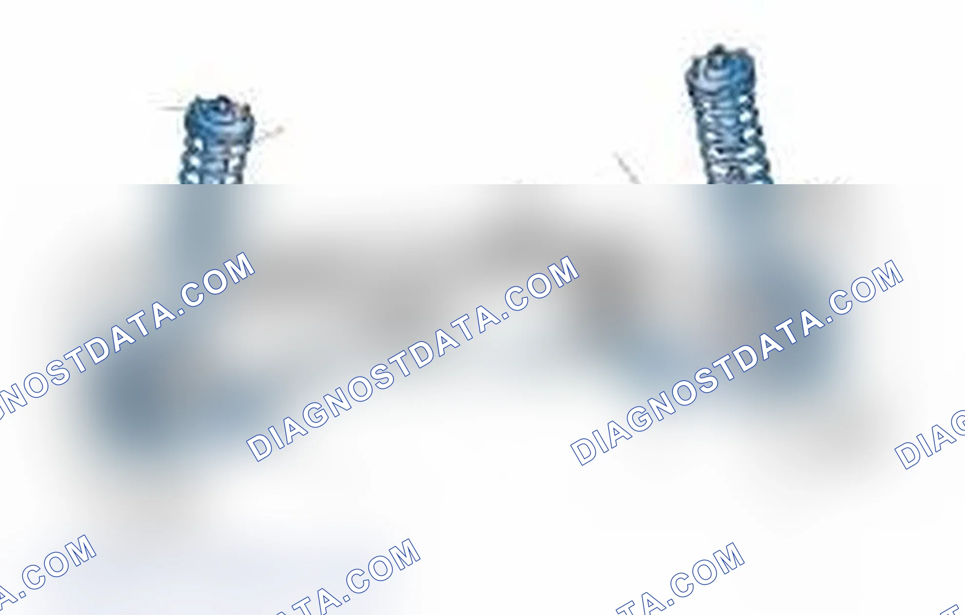 Scheme 25: Typical Front Suspension & Steering Components