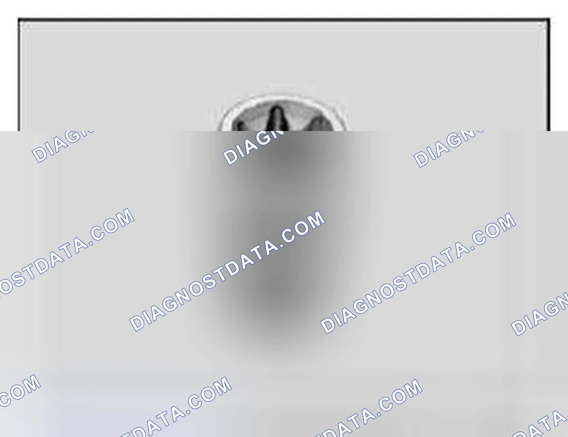 Scheme 423: 11 8 640 Torx socket E10