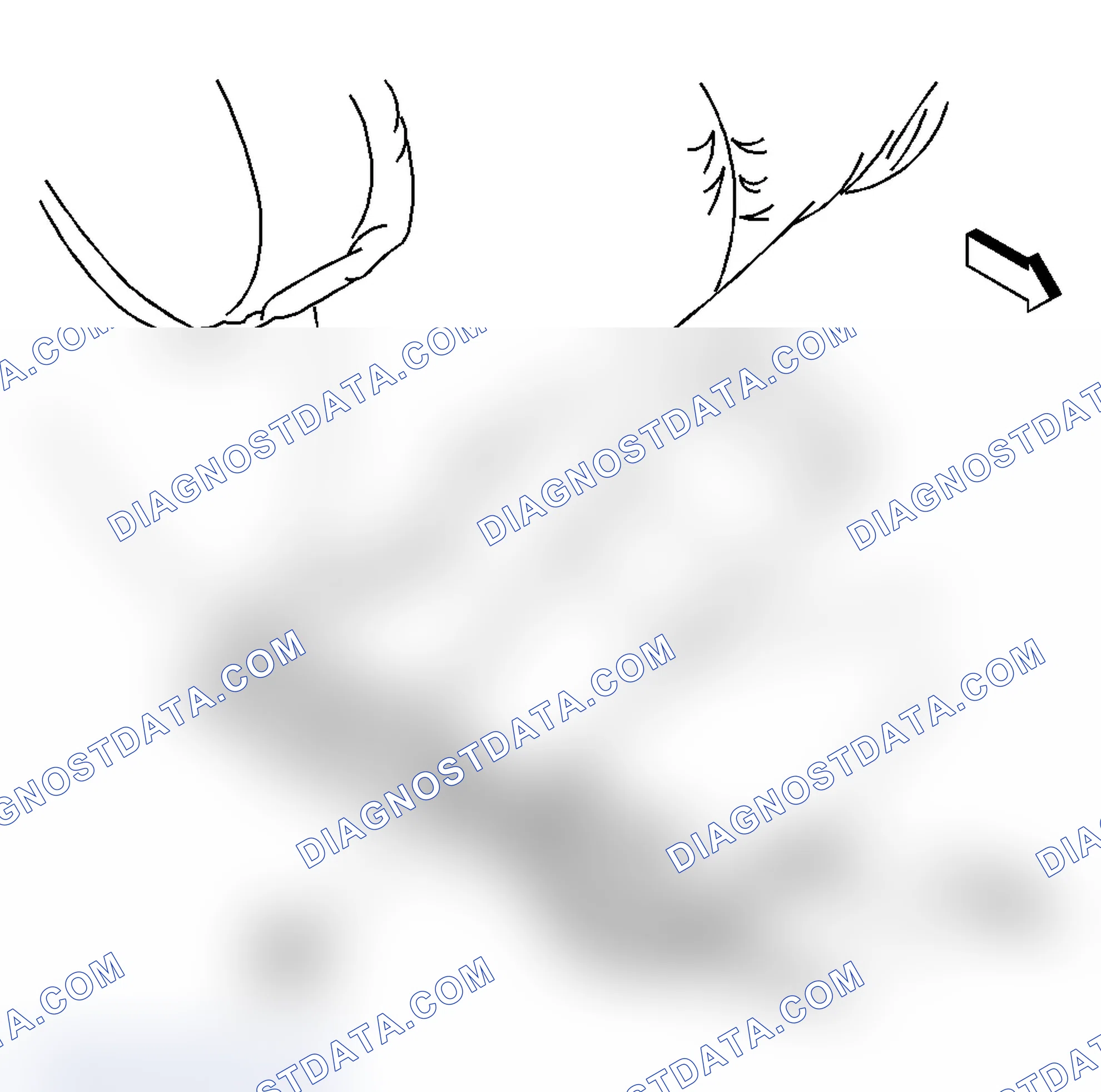 Scheme 2: Seat Belt Component Views