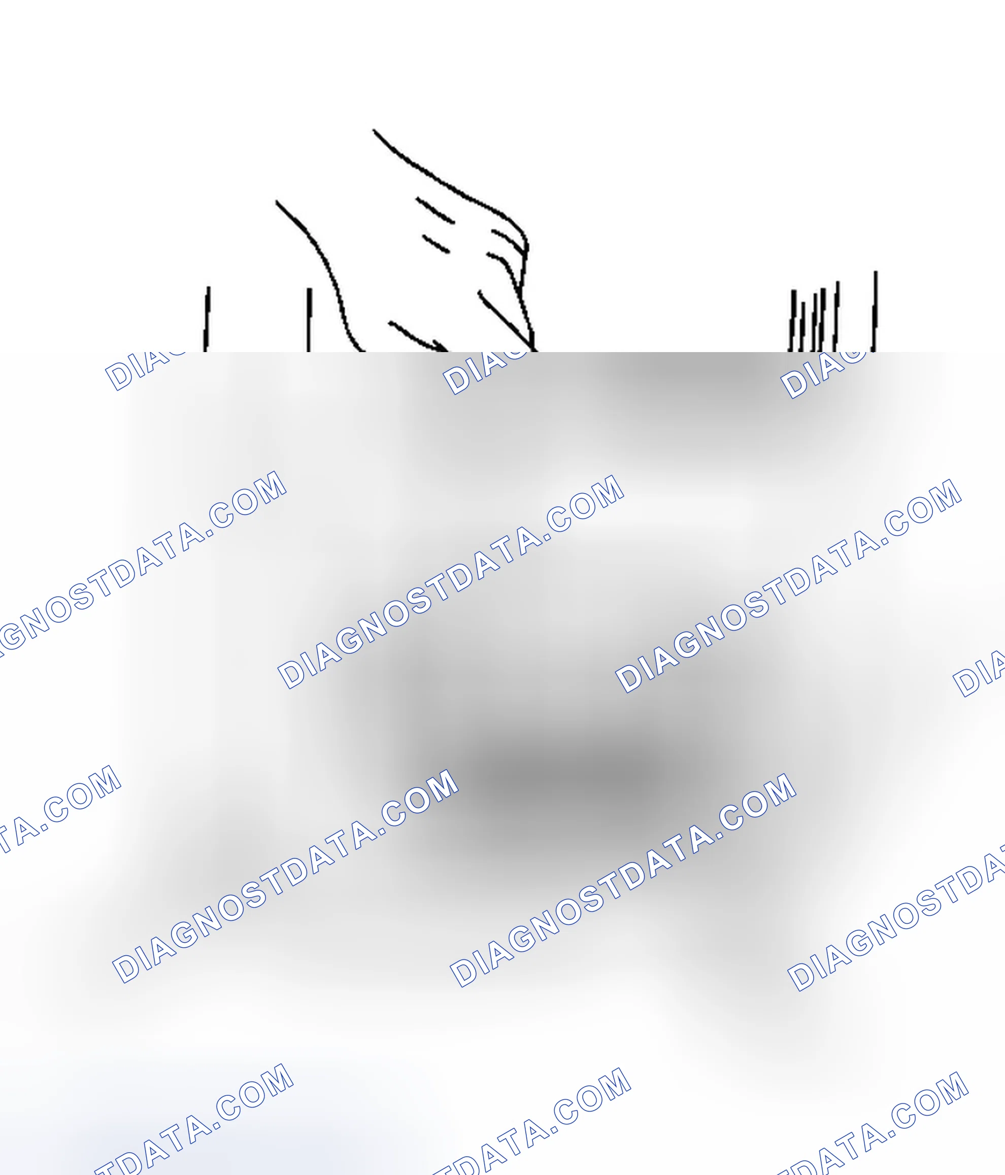 Scheme 1: Removal Procedure