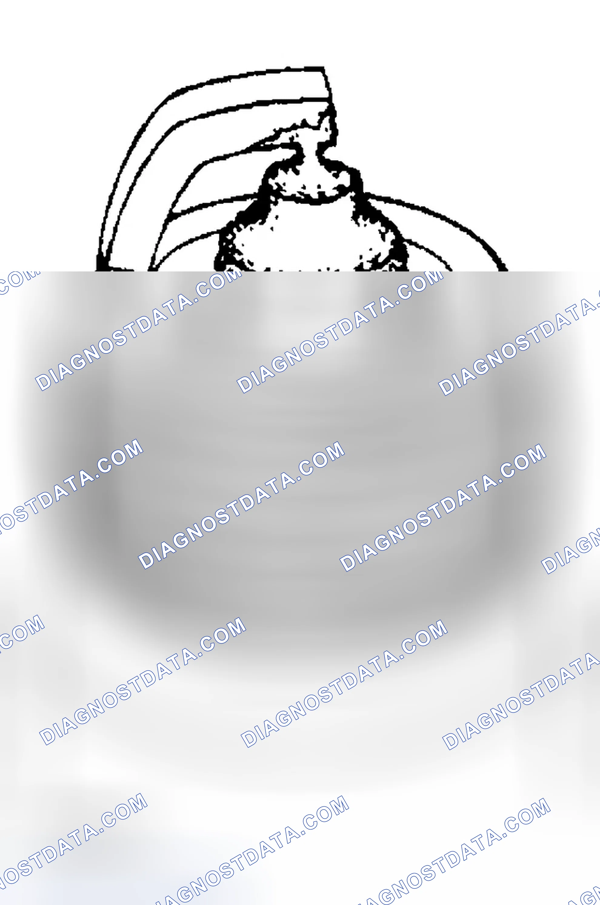 Scheme 391: Spark Plug Inspection