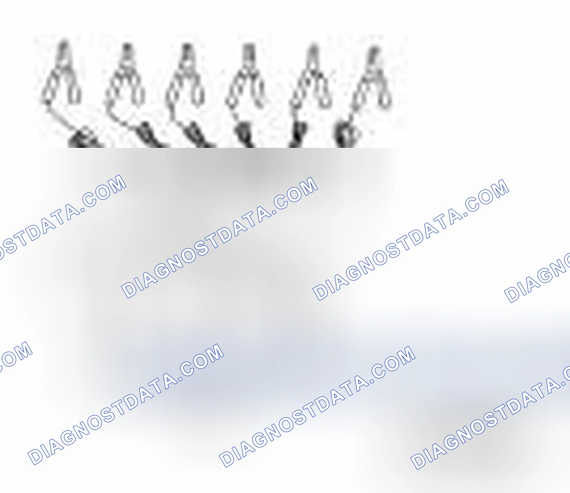 Scheme 118: Special Service Tools