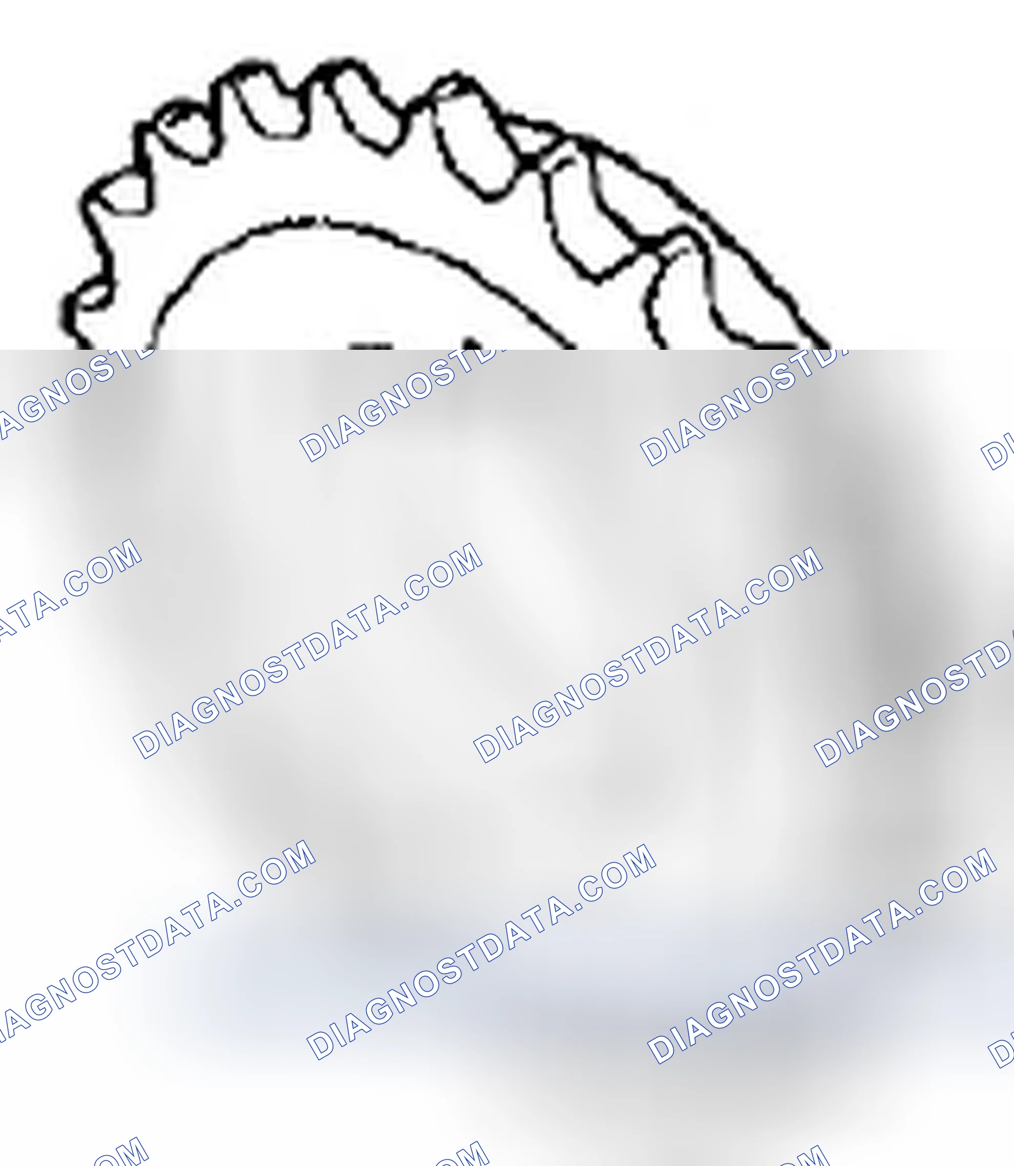 Scheme 148: Crankshaft Timing Sprocket