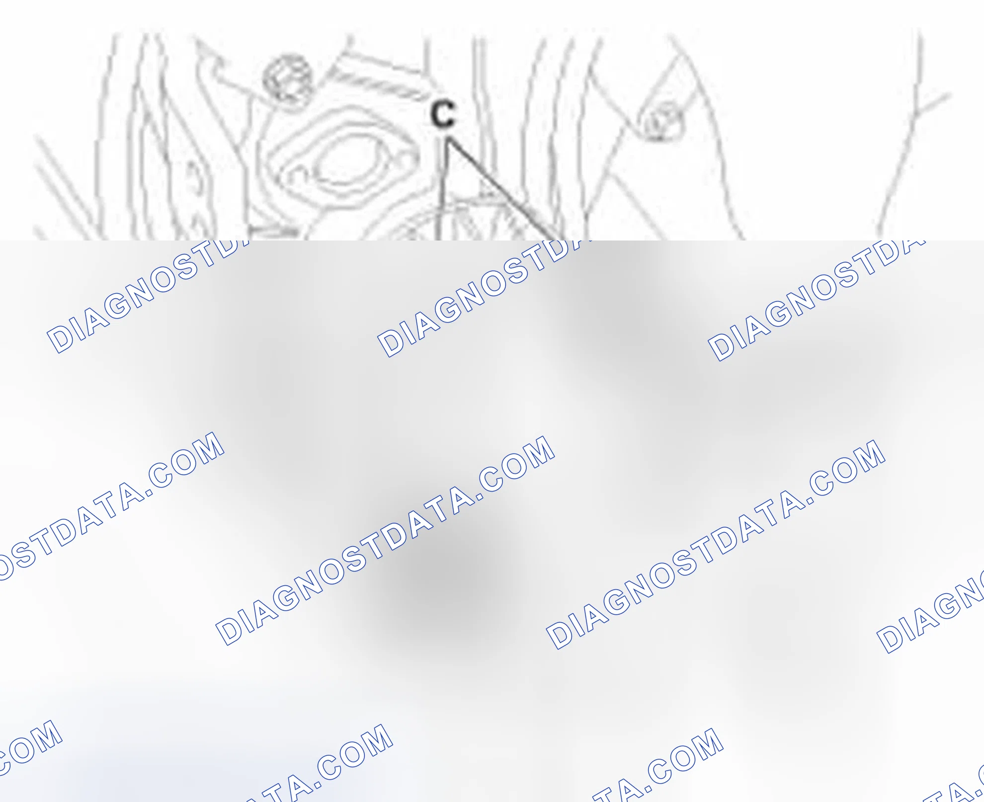 Scheme 105: Removal