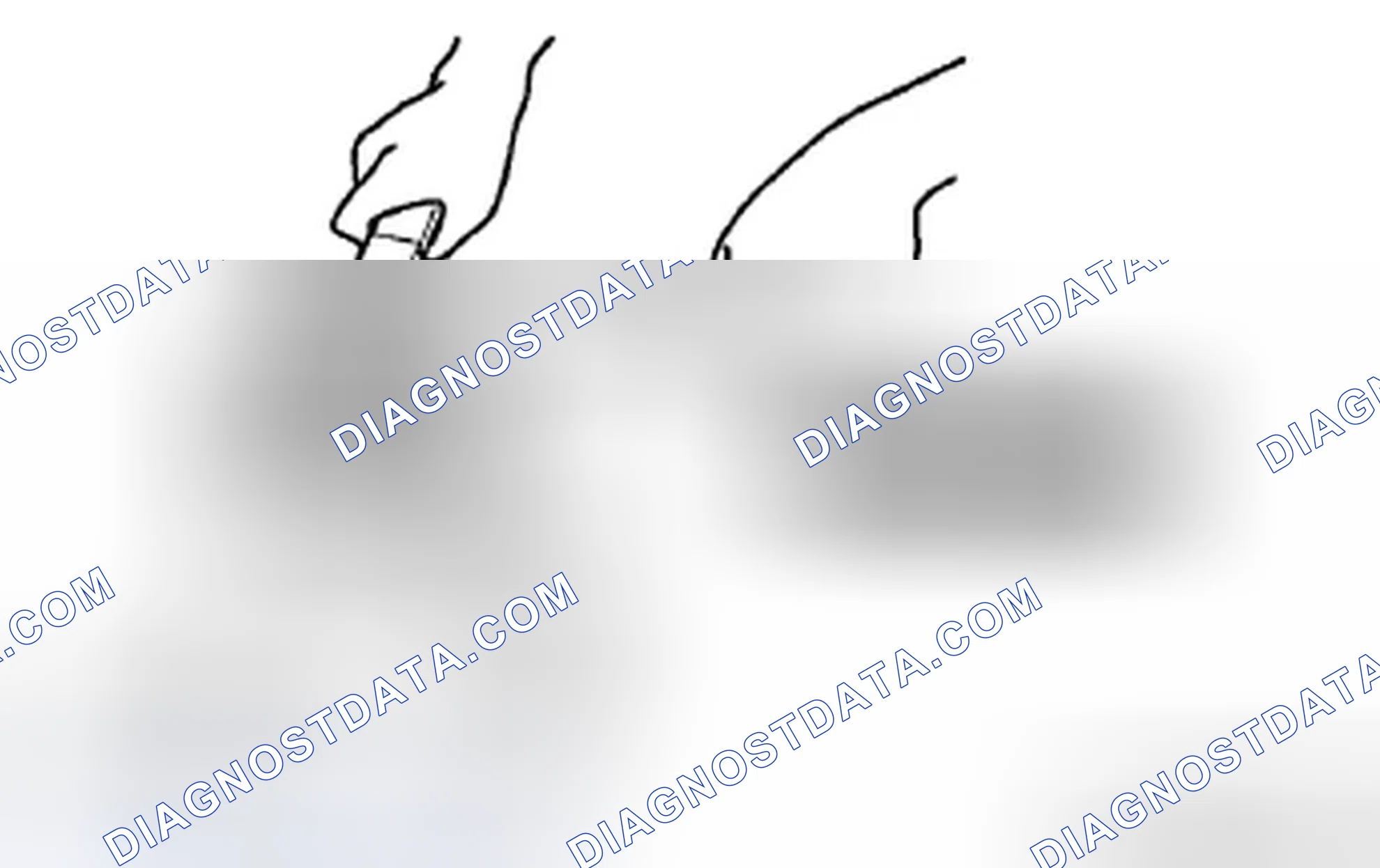 Scheme 43: Locknut Disassembly Note