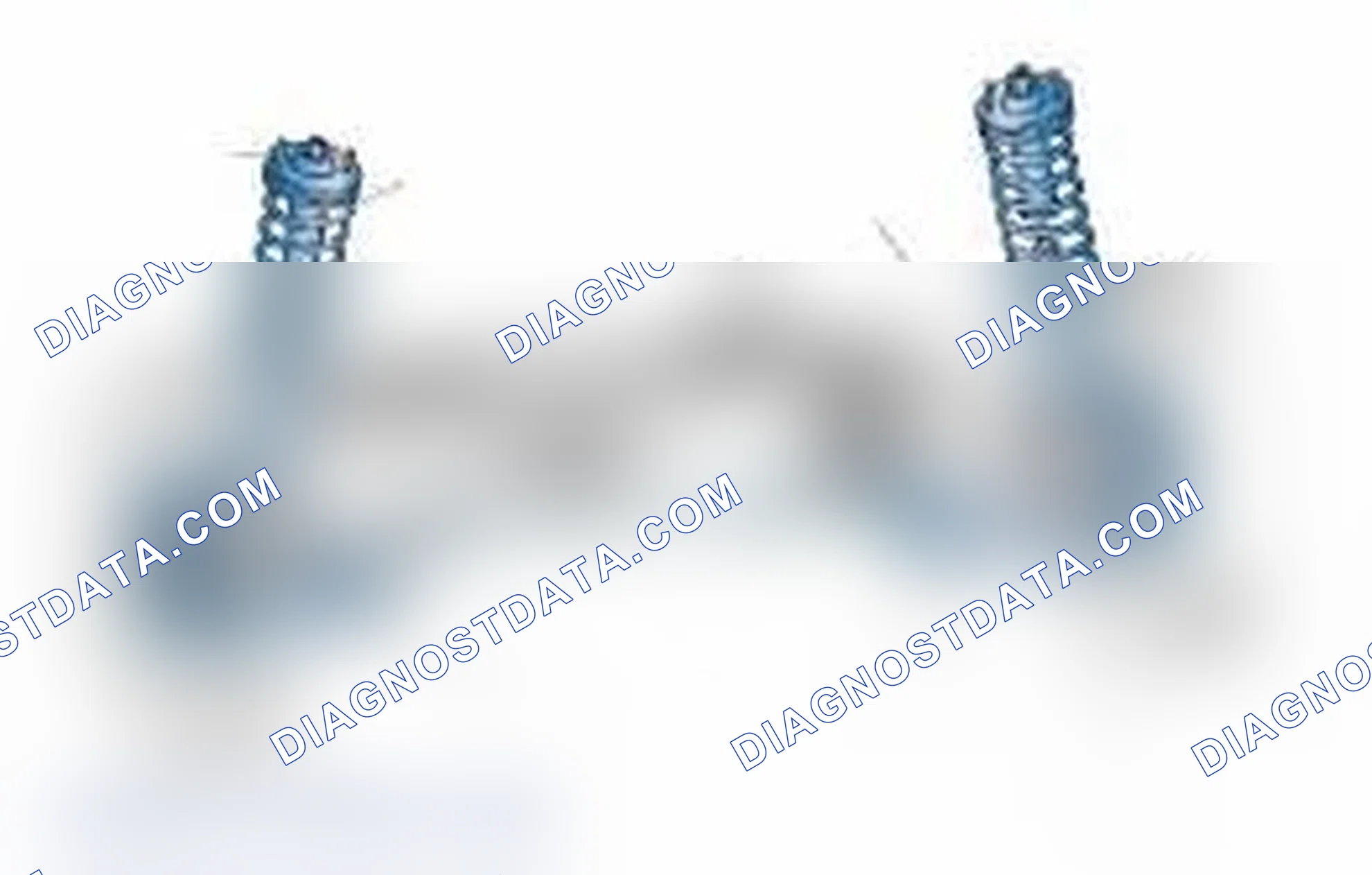 Scheme 25: Typical Front Suspension & Steering Components