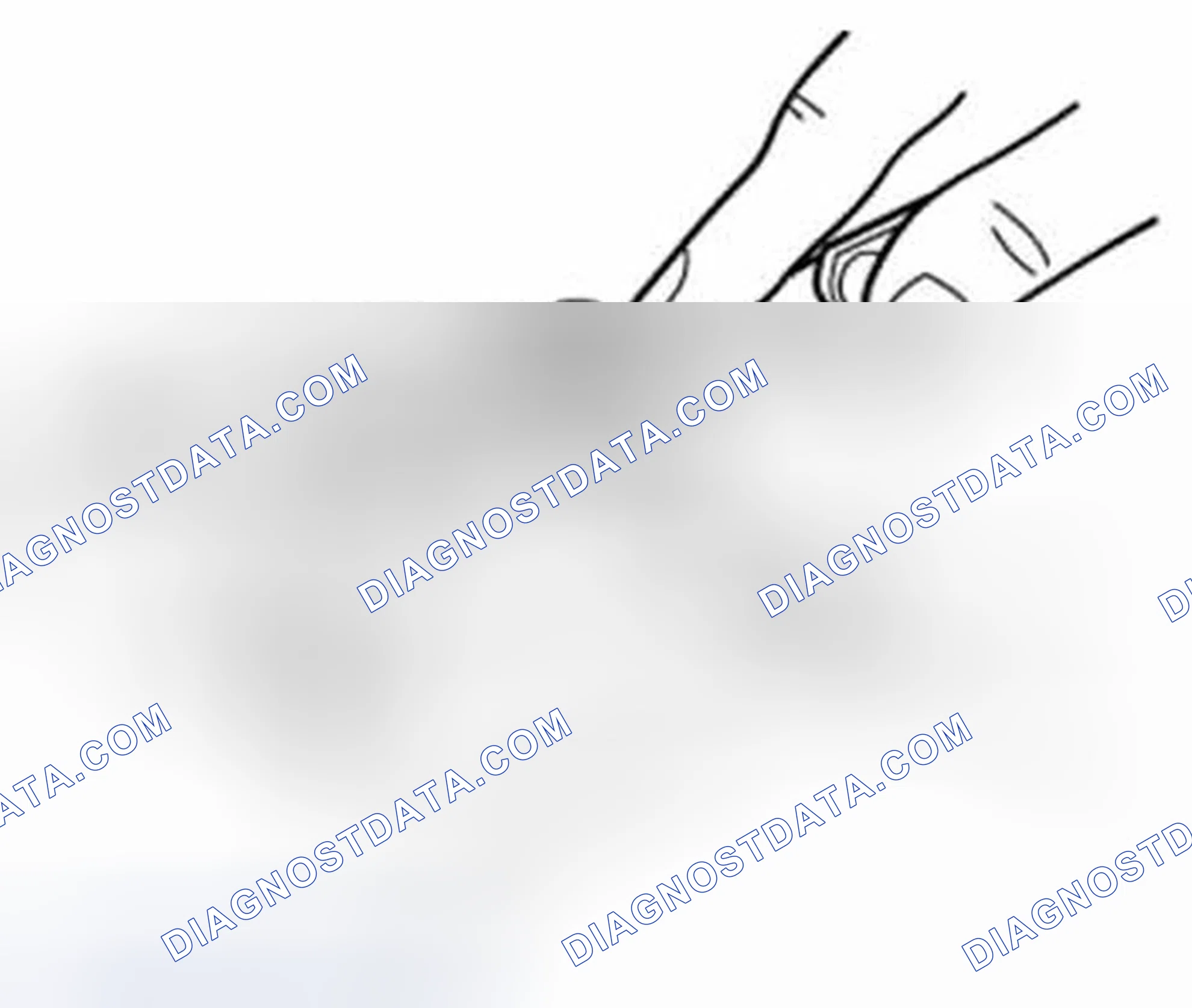 Scheme 210: Big-End Side Clearance