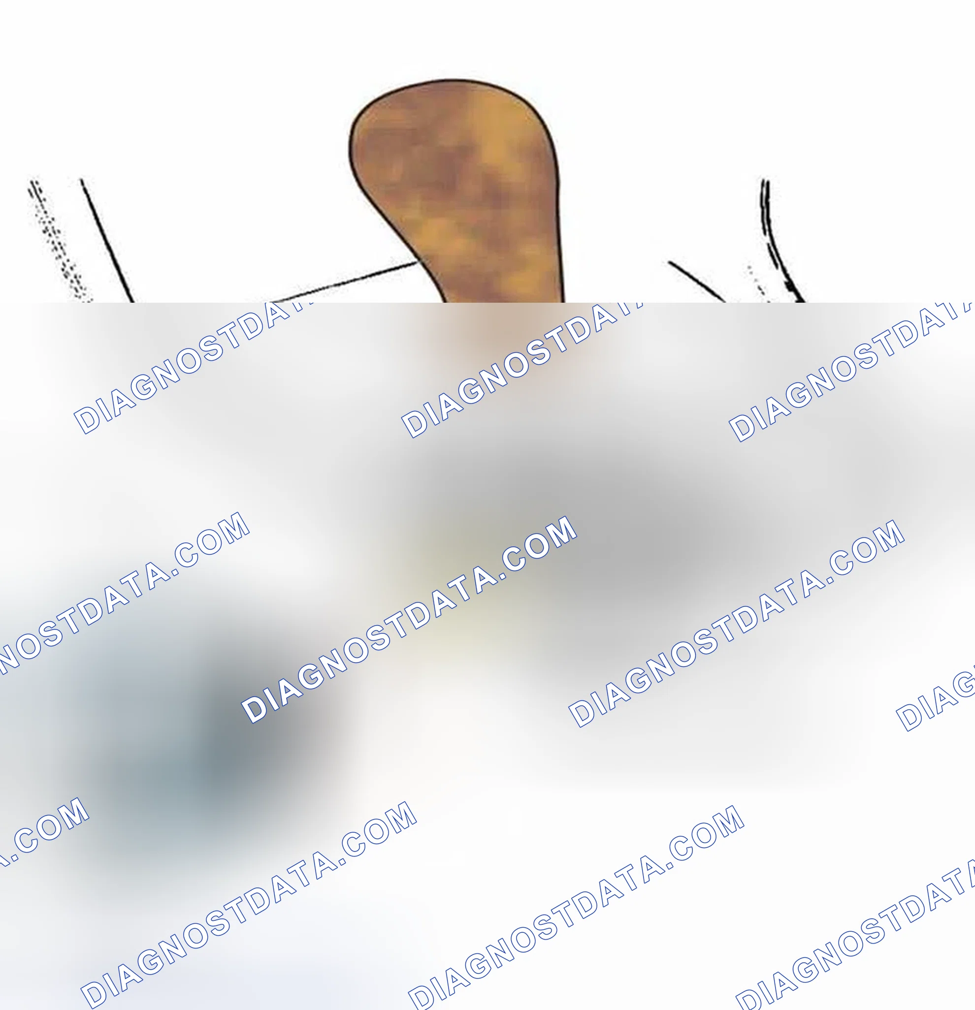 Scheme 215: SHIFT LOCK