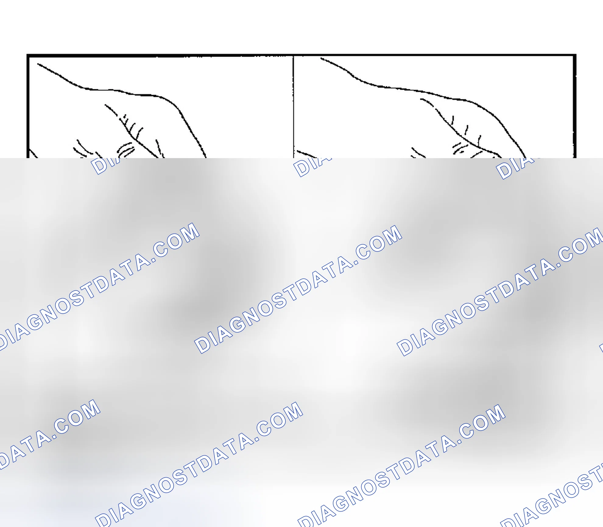 Scheme 877: Overrun Clutch Piston