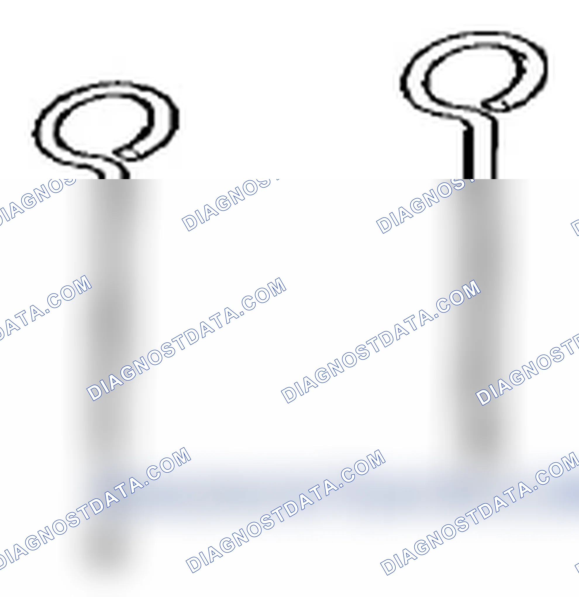 Scheme 306: 11 3 340 Locking pin (2)