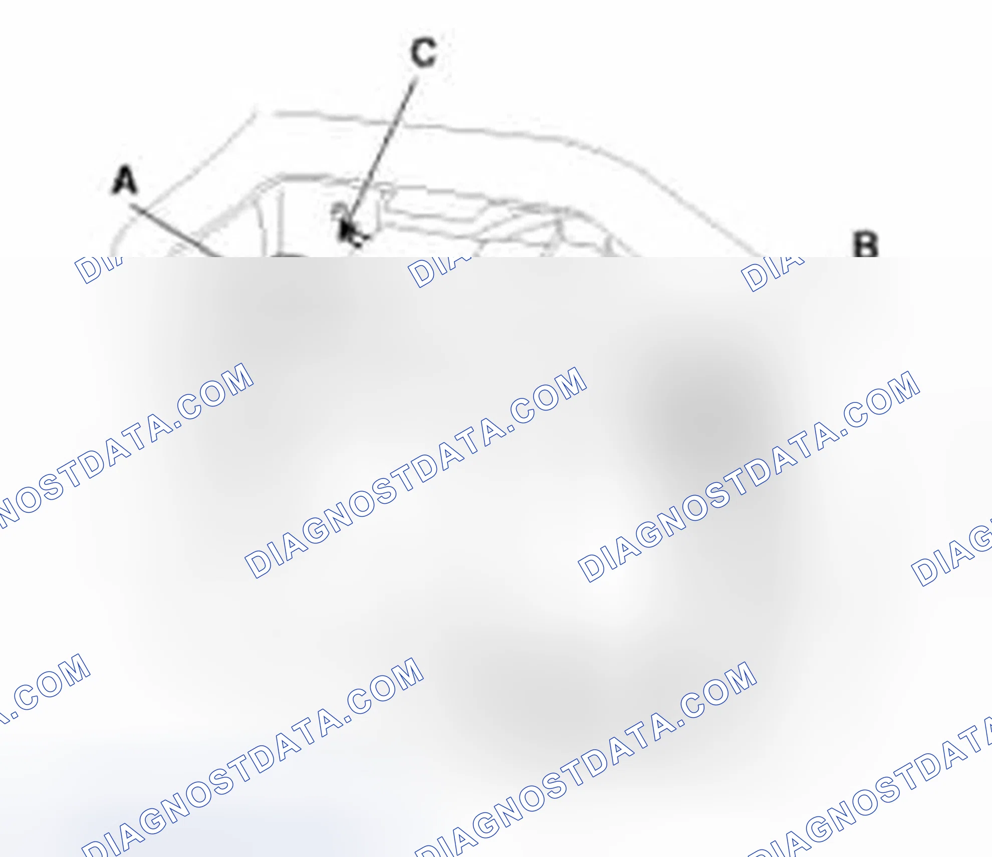 Scheme 262: Removal and Installation