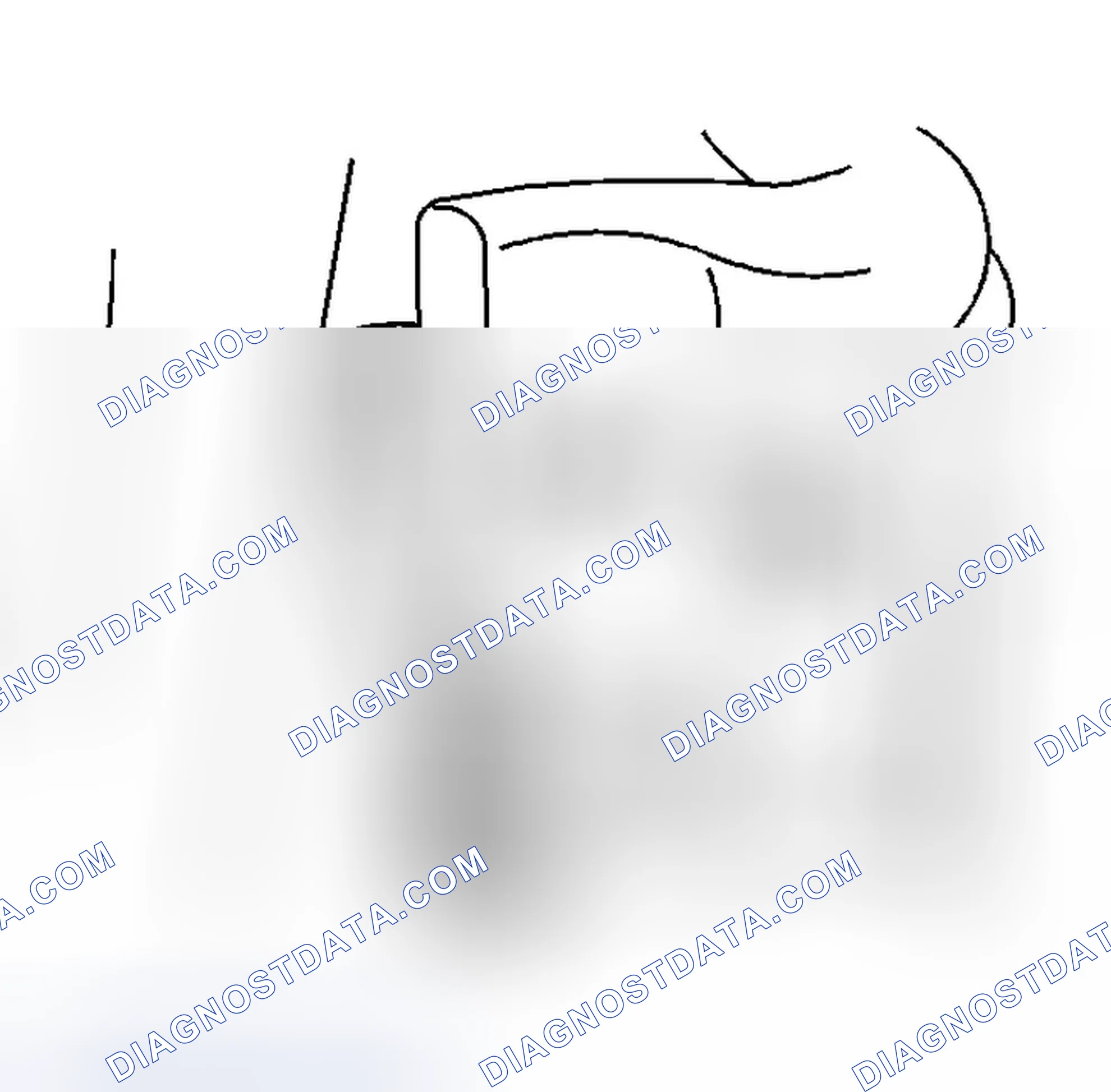 Scheme 3: Removal Procedure