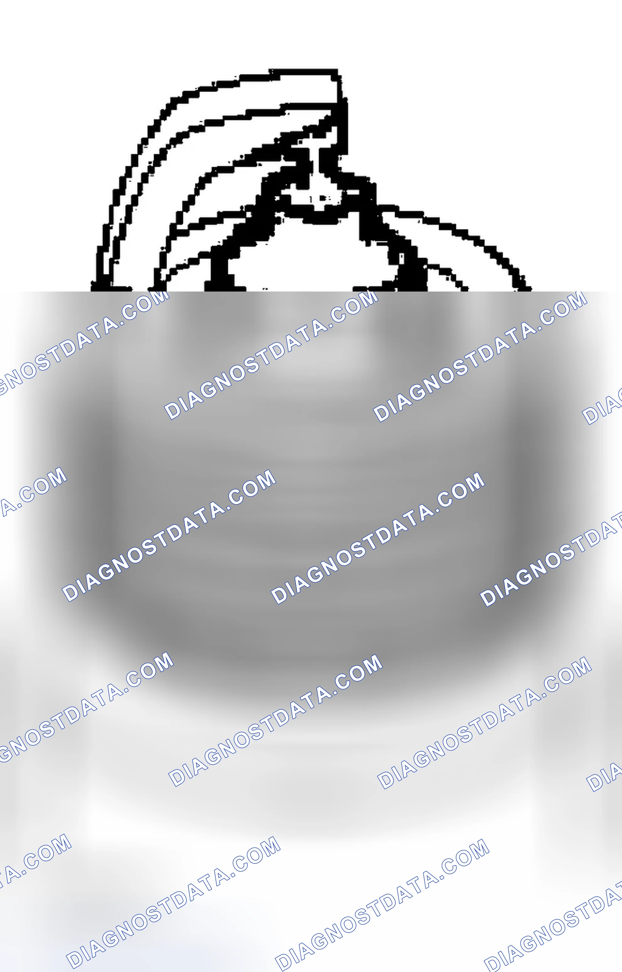 Scheme 64: Spark Plug - Inspection