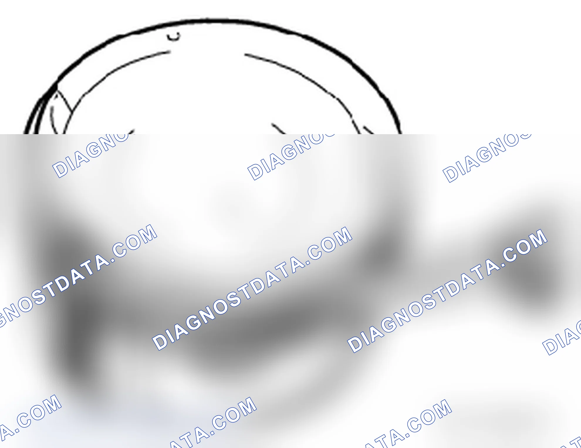 Scheme 35: Piston Ring Measurements