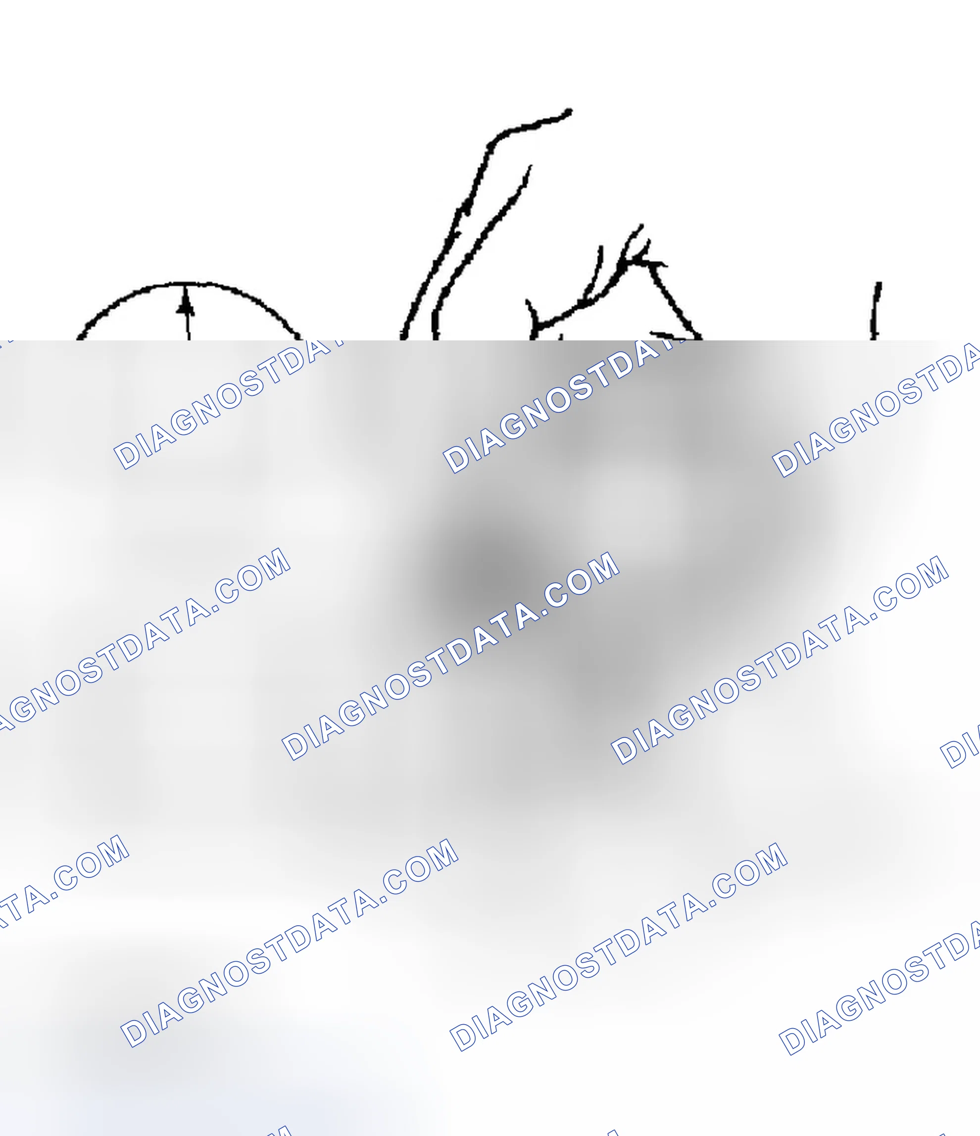 Scheme 36: TAPPET INSPECTION