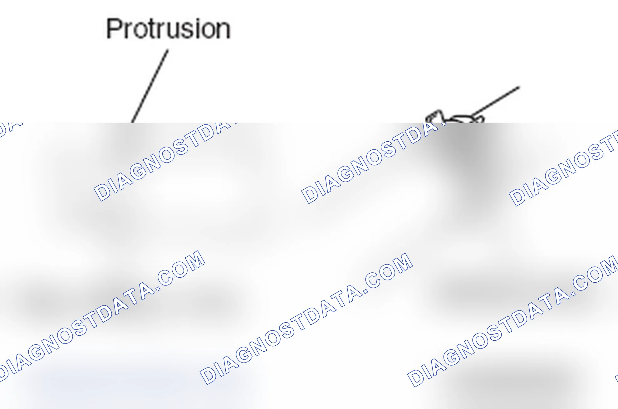 Scheme 33: >> B << RADIATOR LOWER HOSE CONNECTION