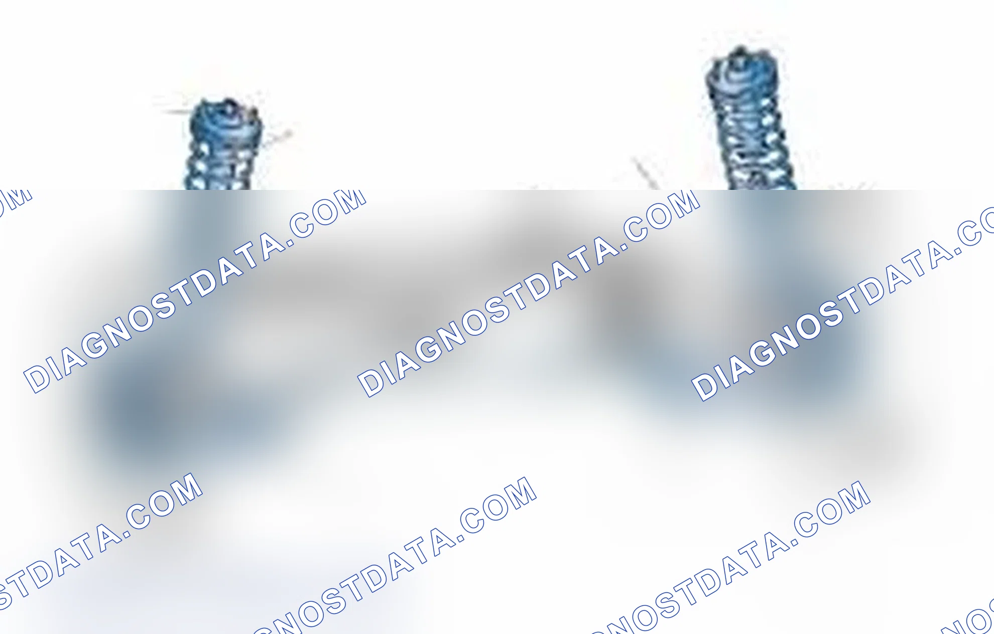 Scheme 25: Typical Front Suspension & Steering Components