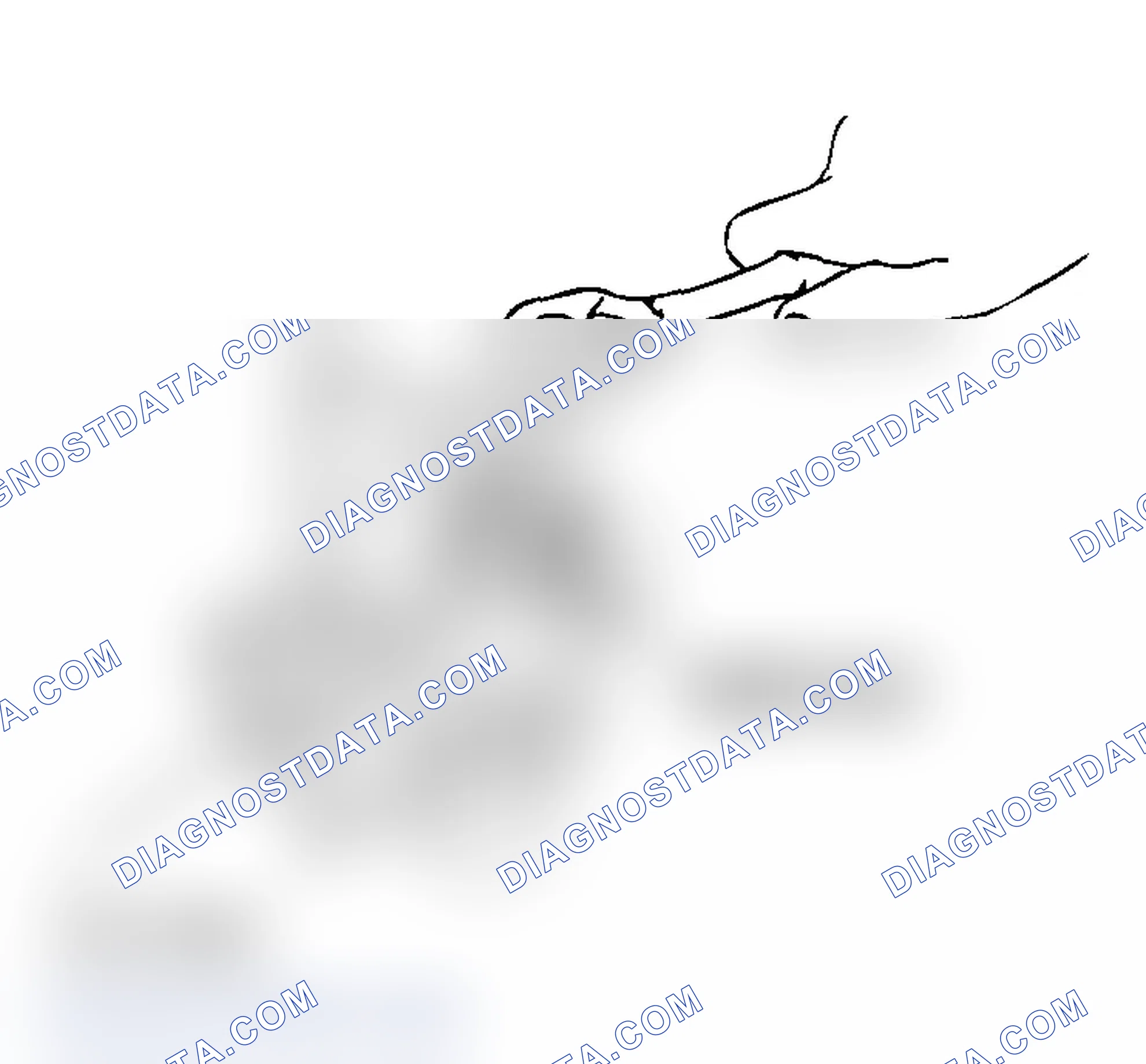 Scheme 240: << A >> RACK SUPPORT COVER REMOVAL