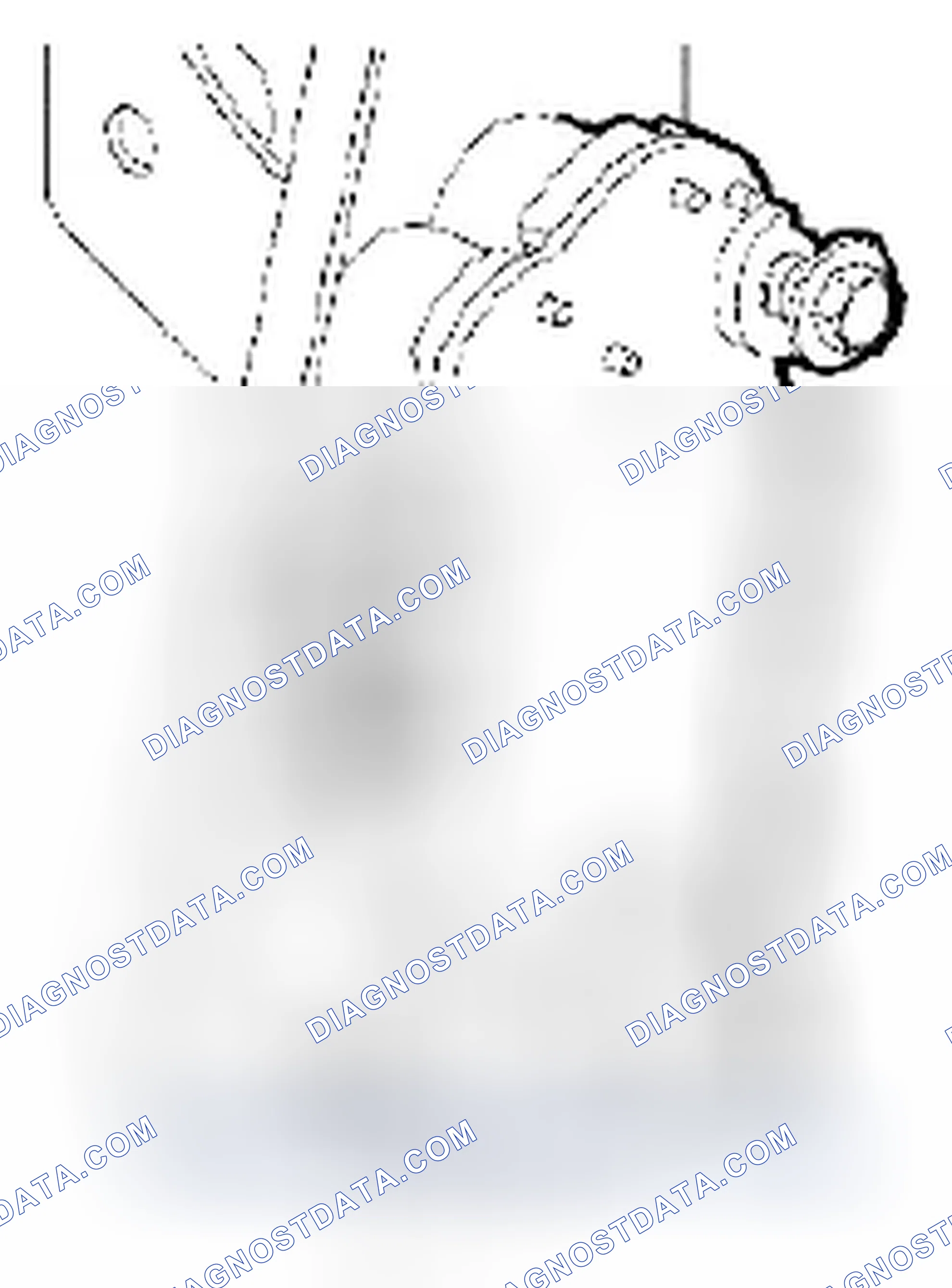 Scheme 25: Installation Procedure