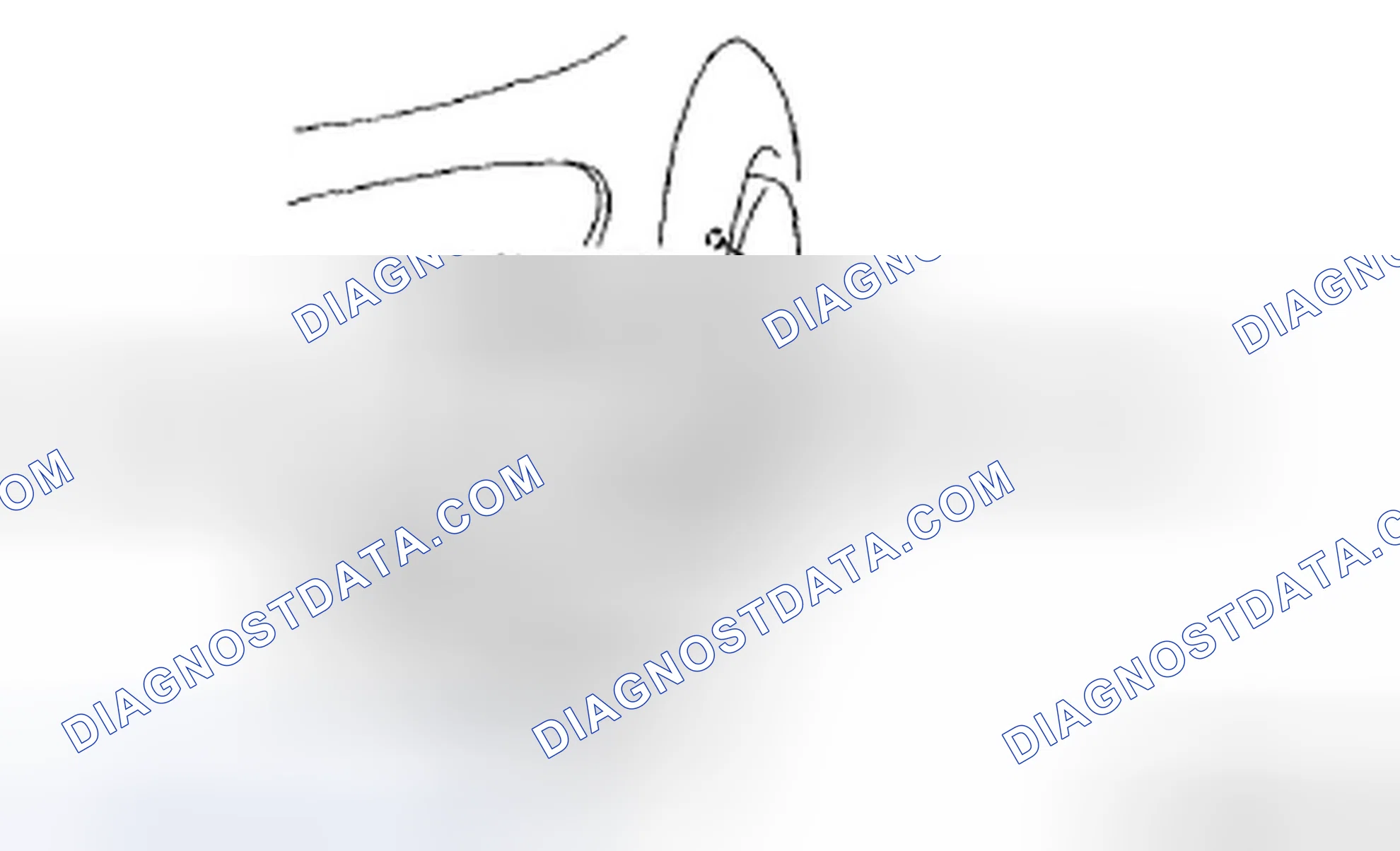 Scheme 3: PARKING/FRONT TURN LIGHT BULB REMOVAL/INSTALLATION