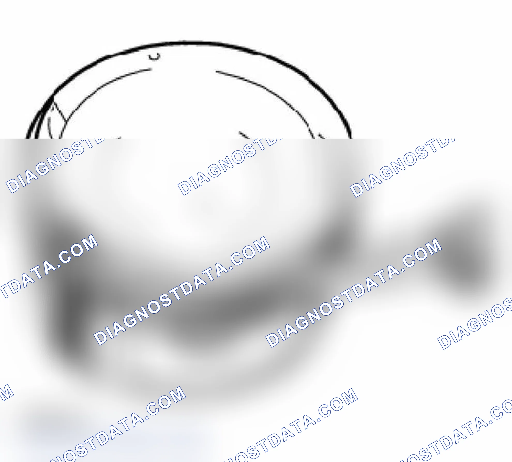 Scheme 18: Piston Ring Measurements