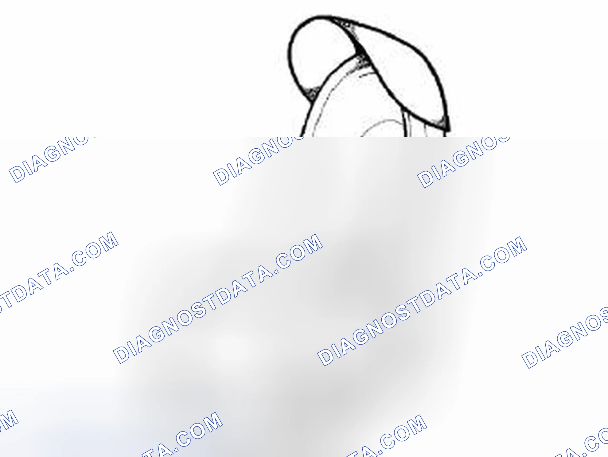 Scheme 83: SUN VISOR