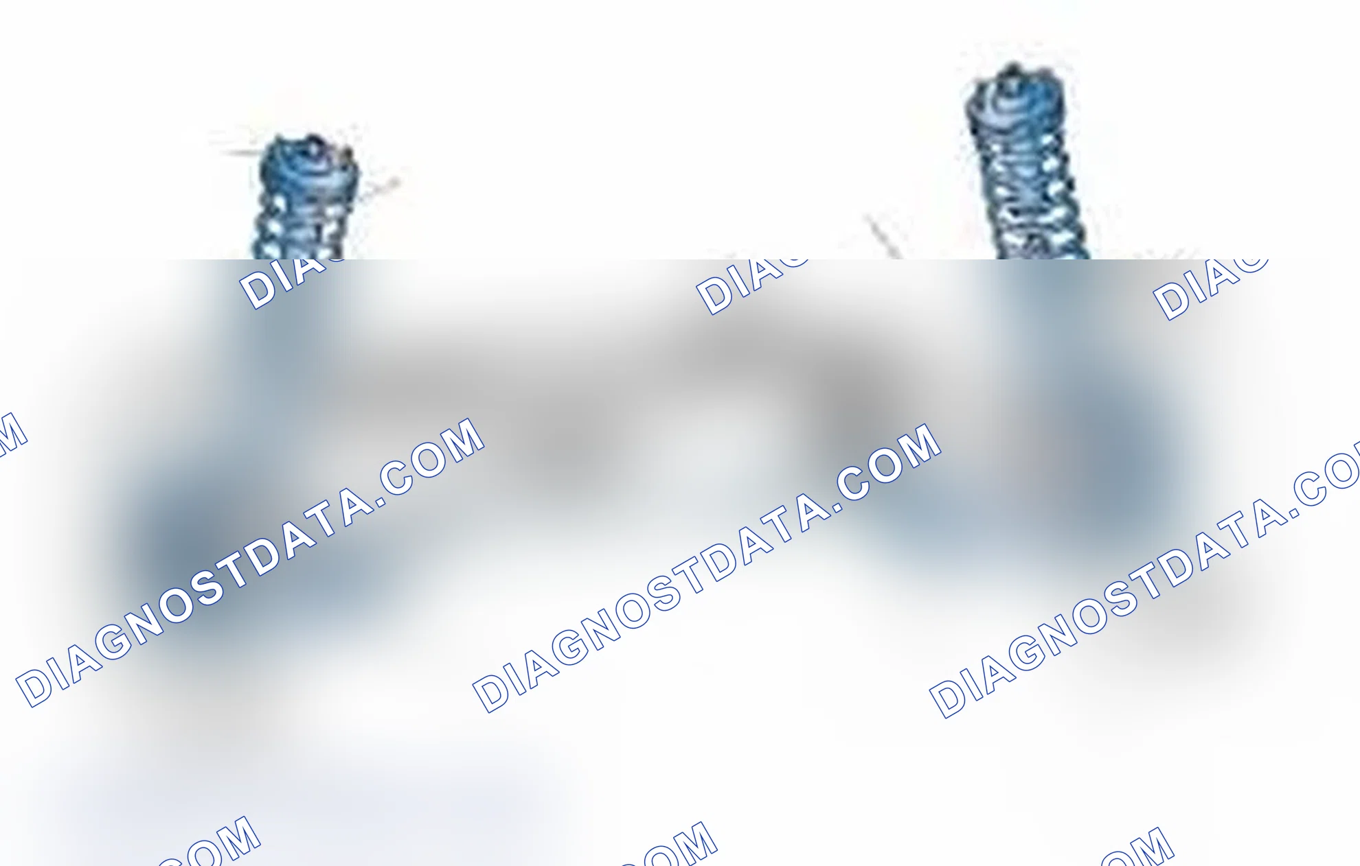 Scheme 25: Typical Front Suspension & Steering Components