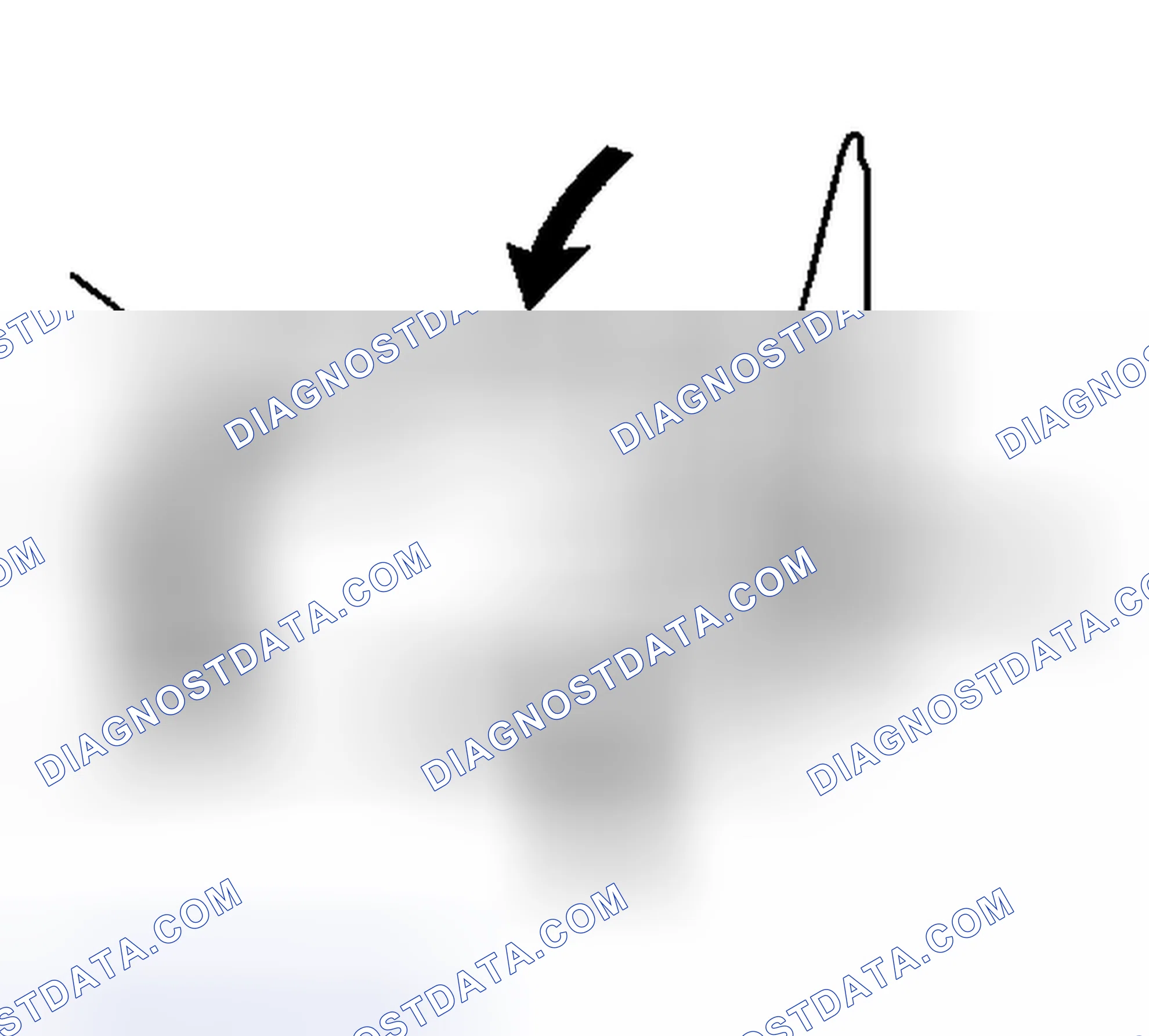 Scheme 12: Installation Procedure