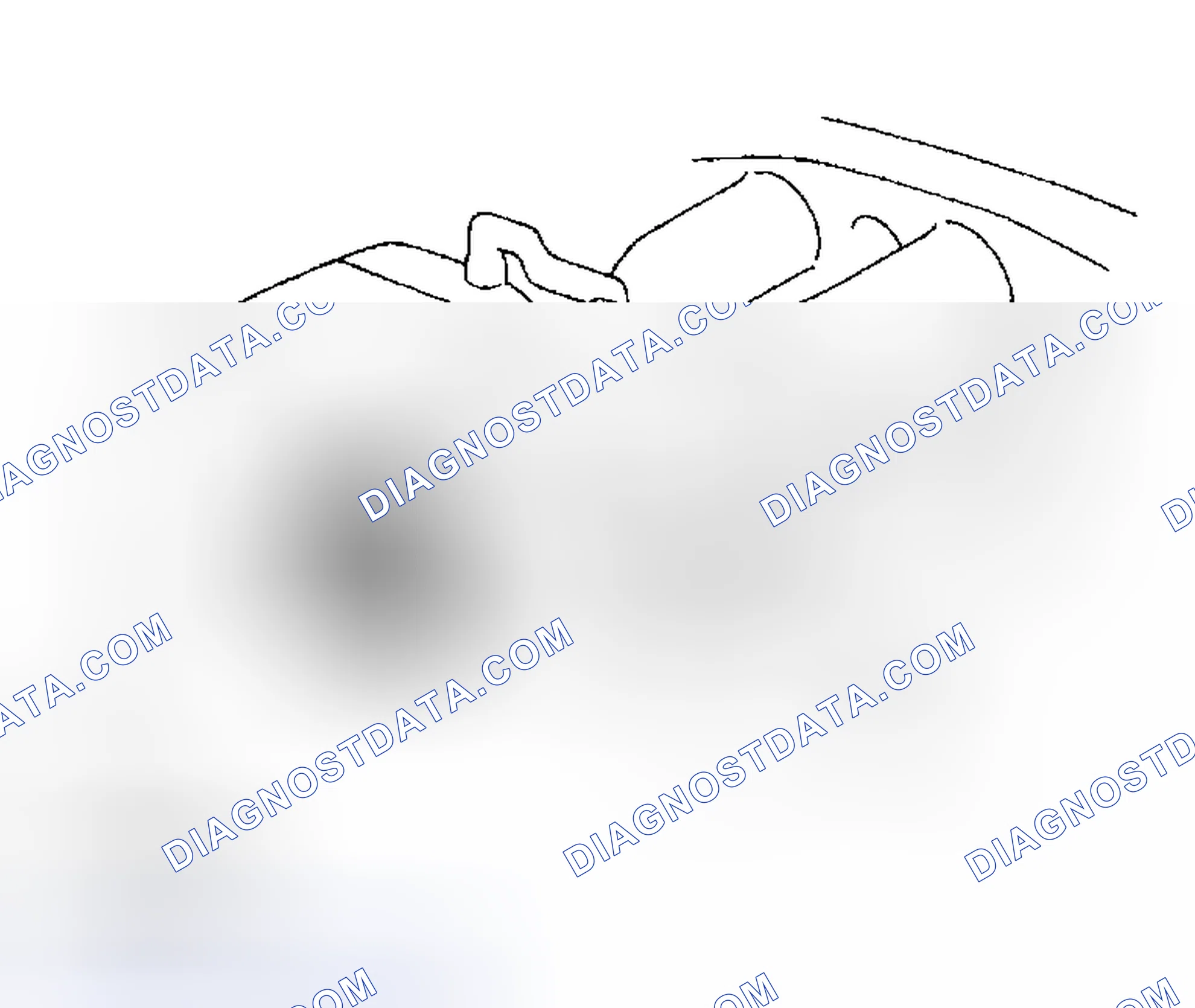 Scheme 51: REMOVAL AND INSTALLATION OF ENGINE INTAKE PARTS
