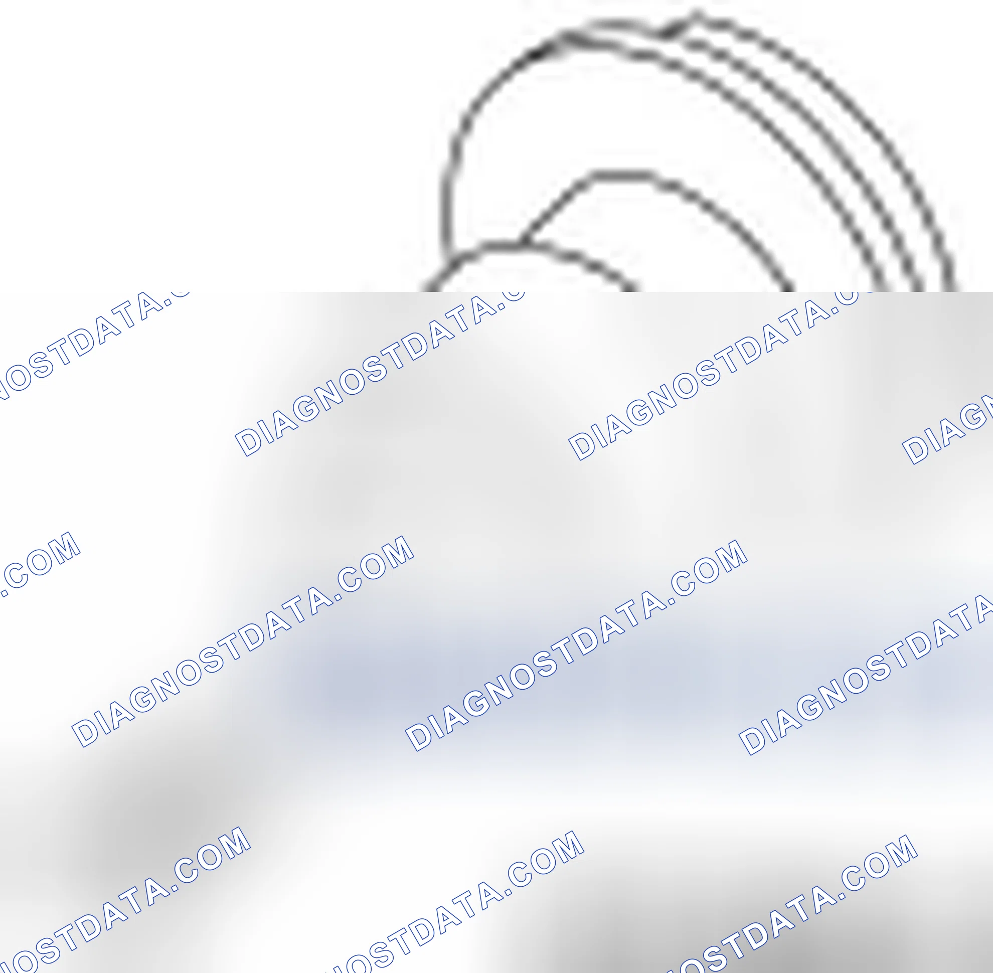 Scheme 68: Crankshaft Pulley