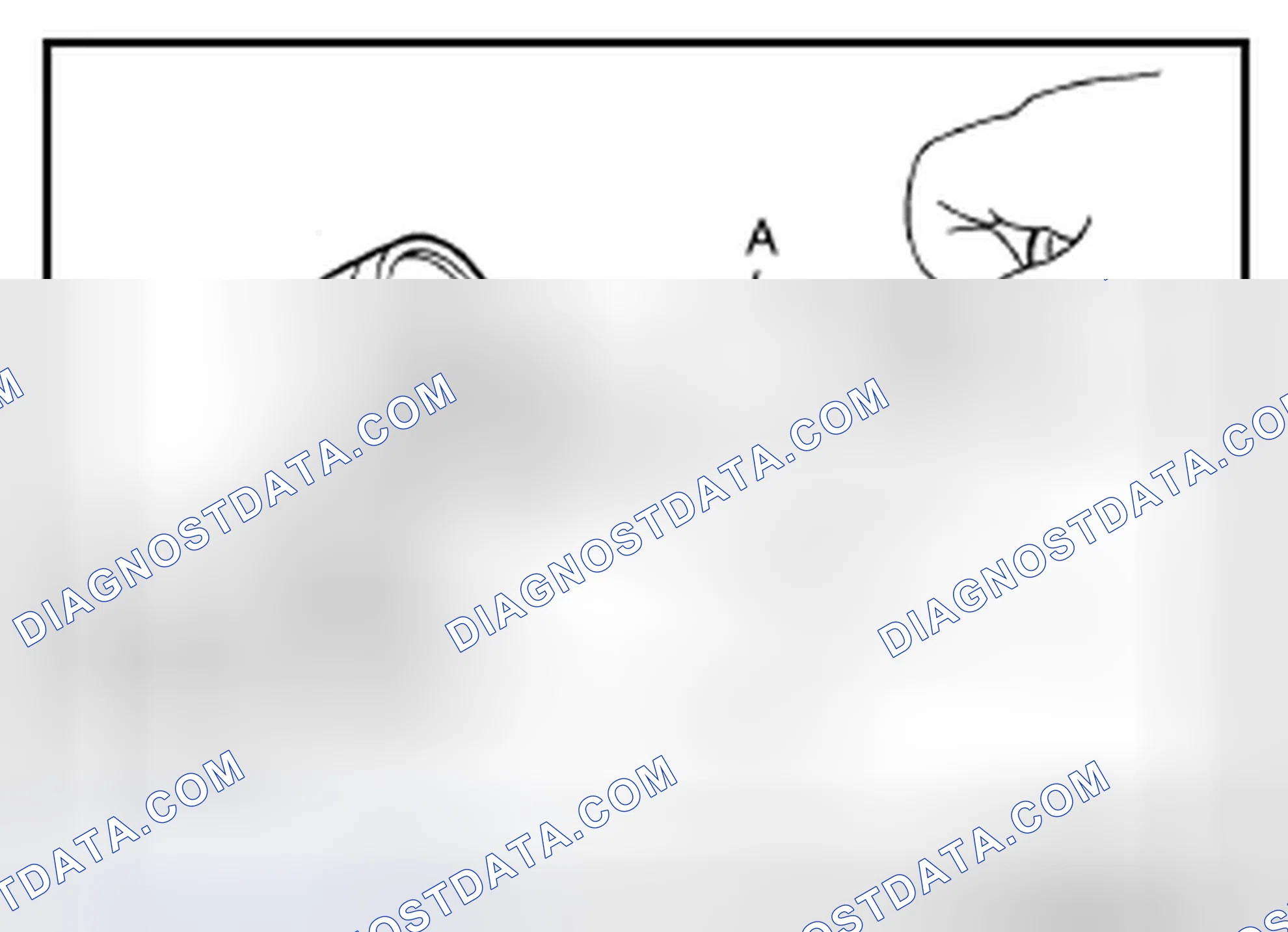 Scheme 17