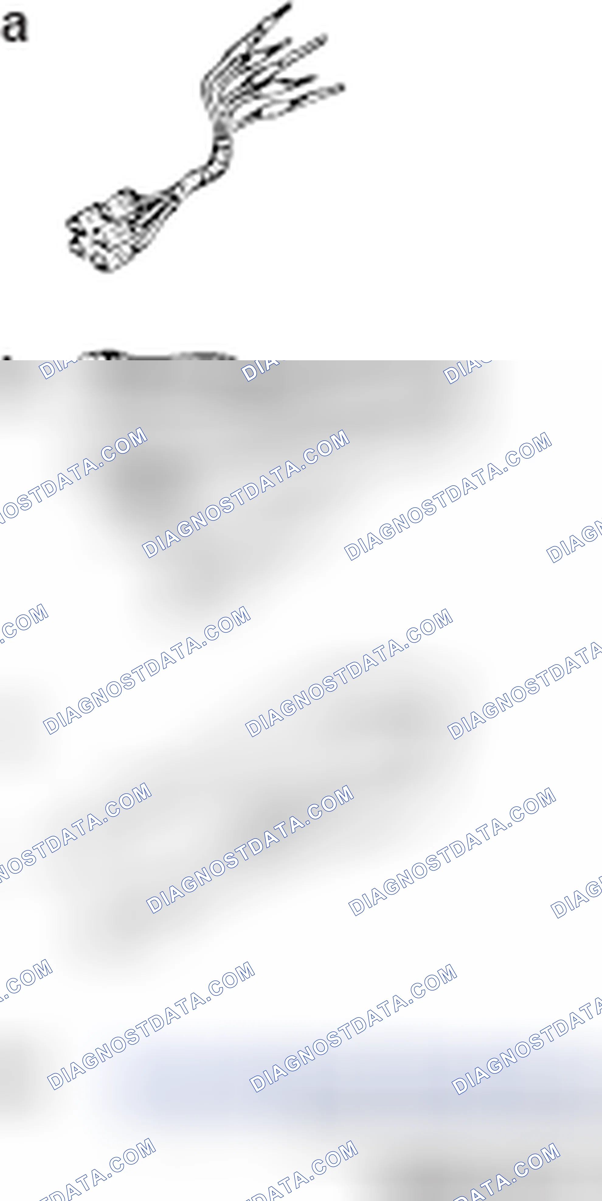 Scheme 374: SPECIAL TOOLS