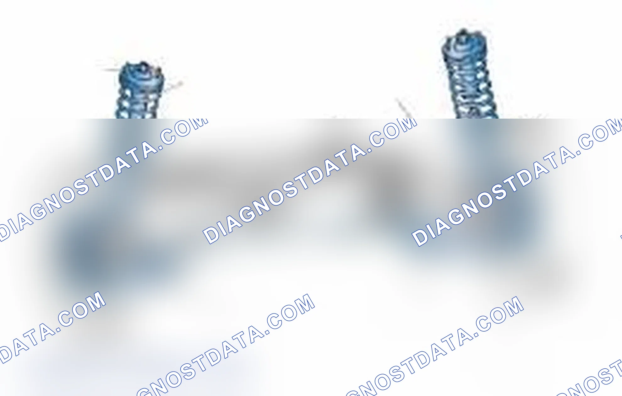 Scheme 25: Typical Front Suspension & Steering Components