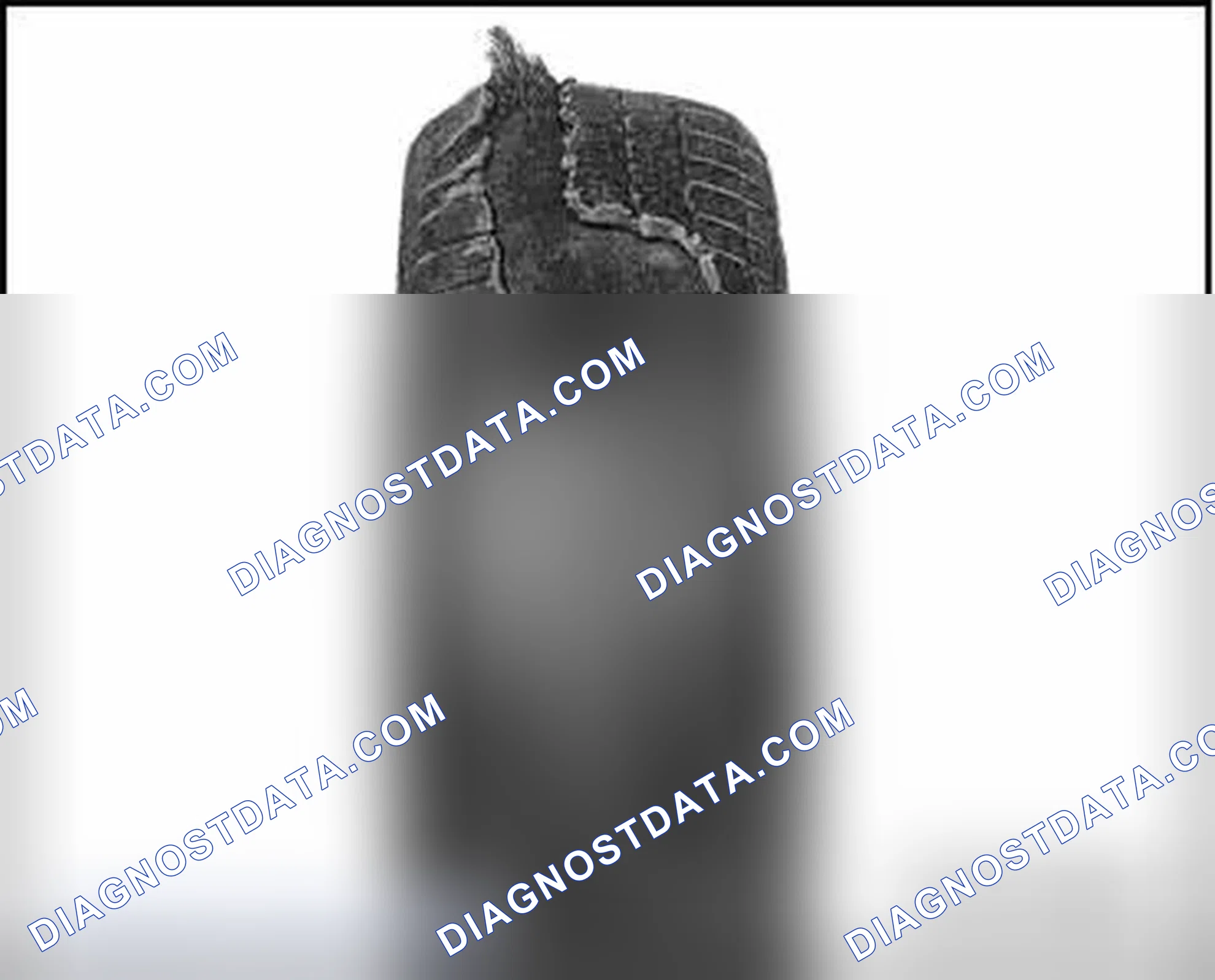 Scheme 27: DISINTEGRATED TREAD