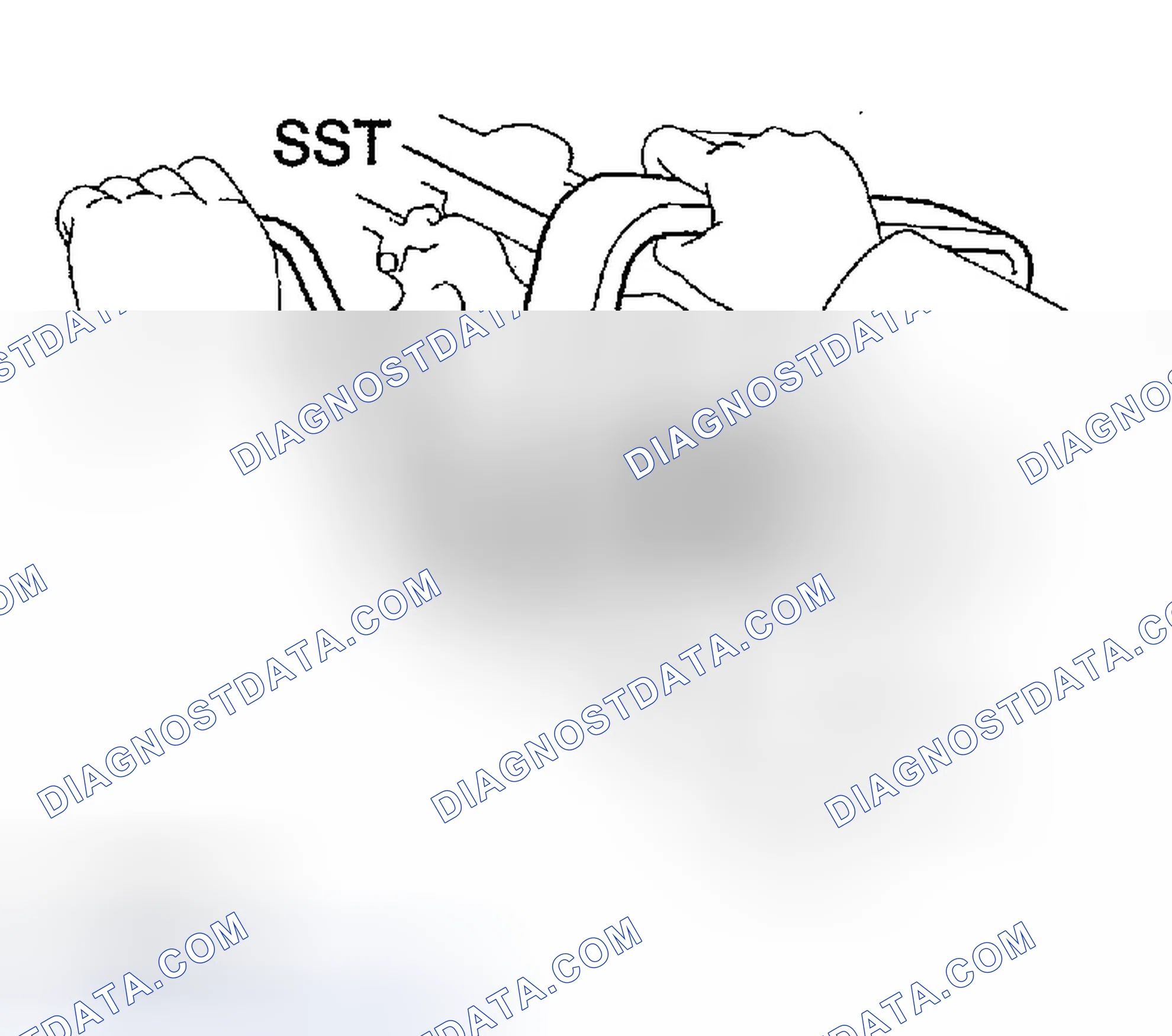 Scheme 100: DISASSEMBLY