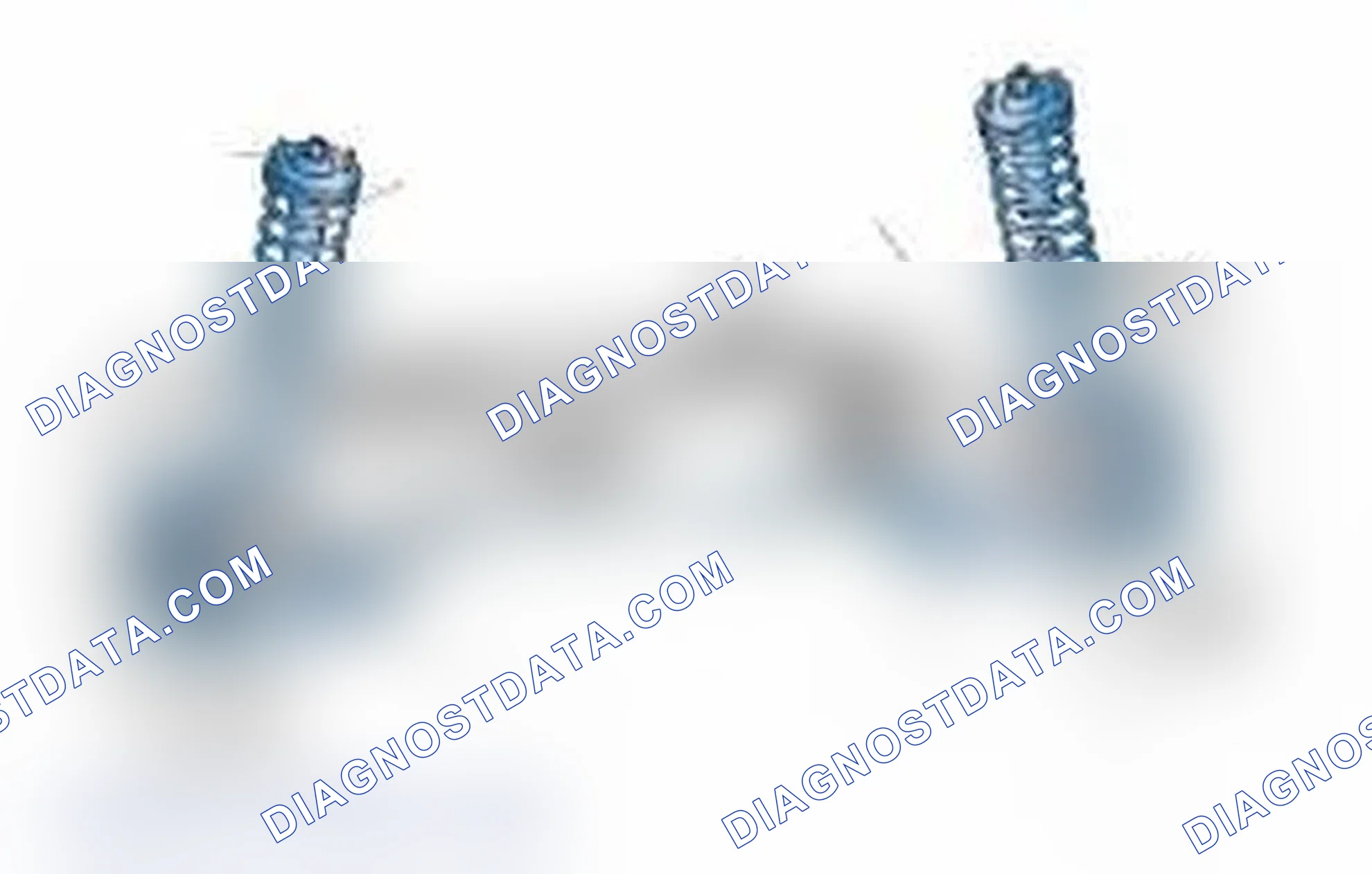 Scheme 25: Typical Front Suspension & Steering Components