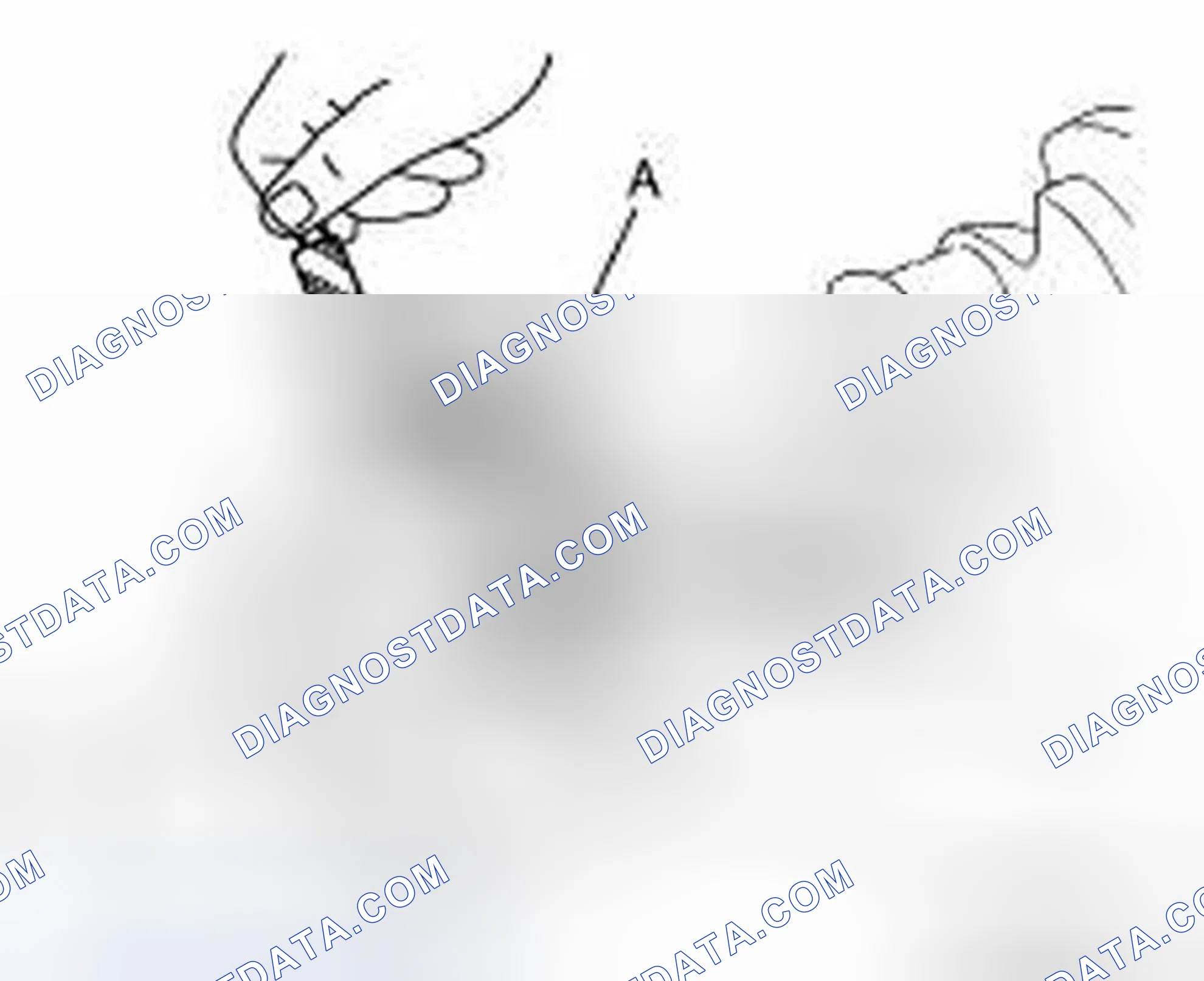 Scheme 250: CRANKSHAFT PIN JOURNAL DIAMETER