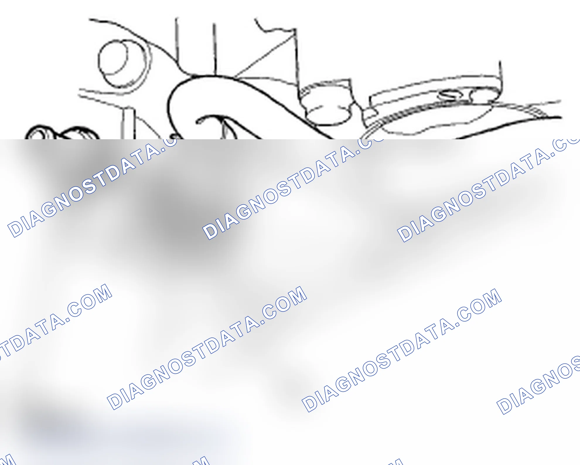 Scheme 106: PCV Valve Replacement