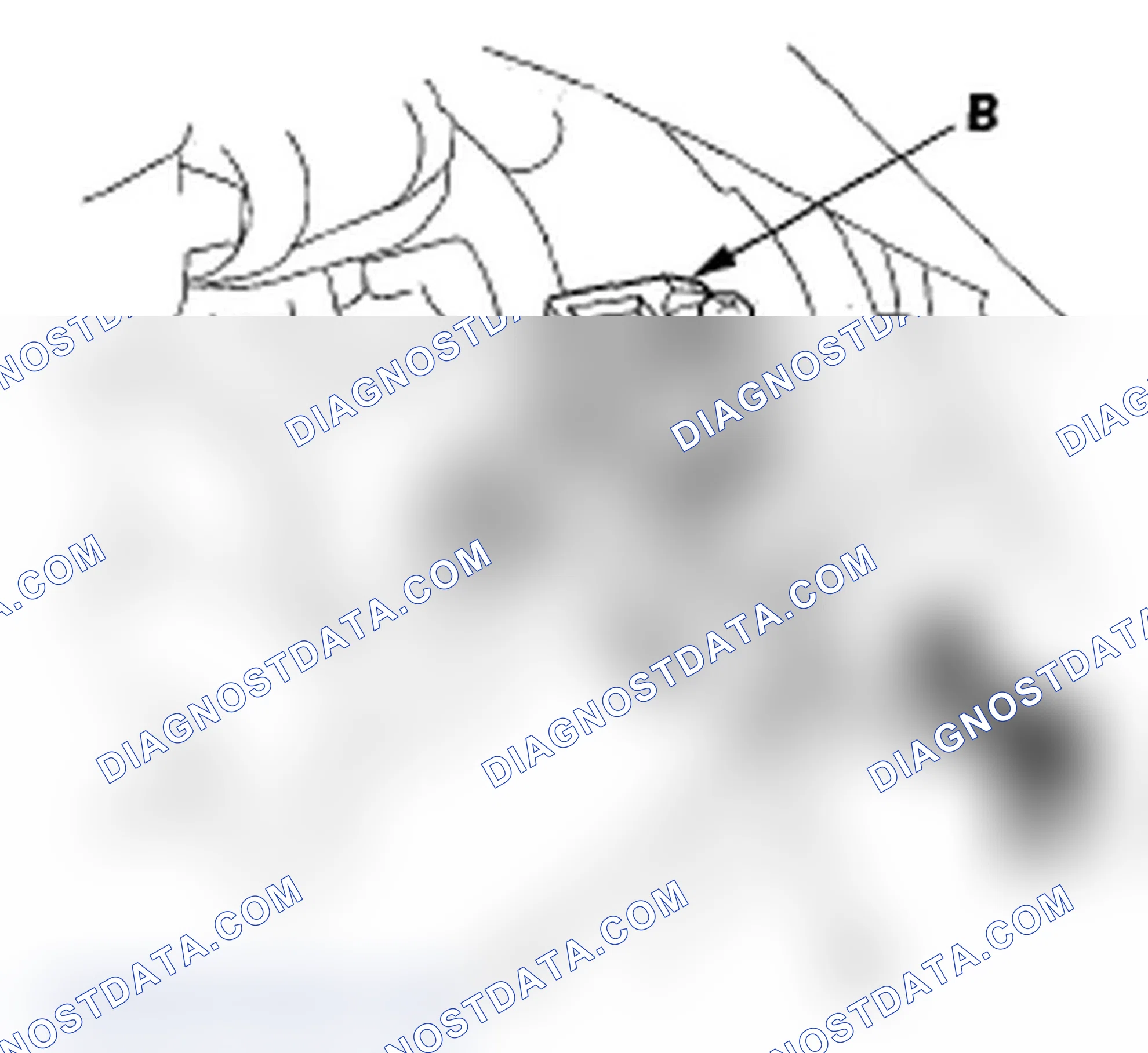 Scheme 105: DTC P0556: Brake Booster Pressure Sensor Circuit Range/Performance Problem