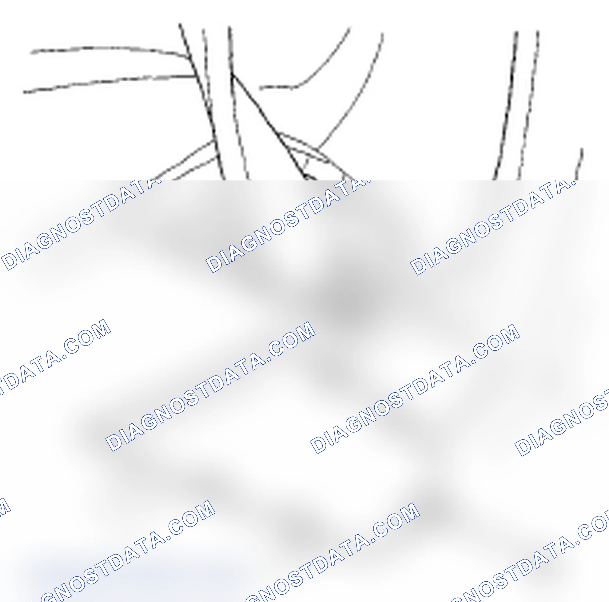 Scheme 2: Front Seat Belt