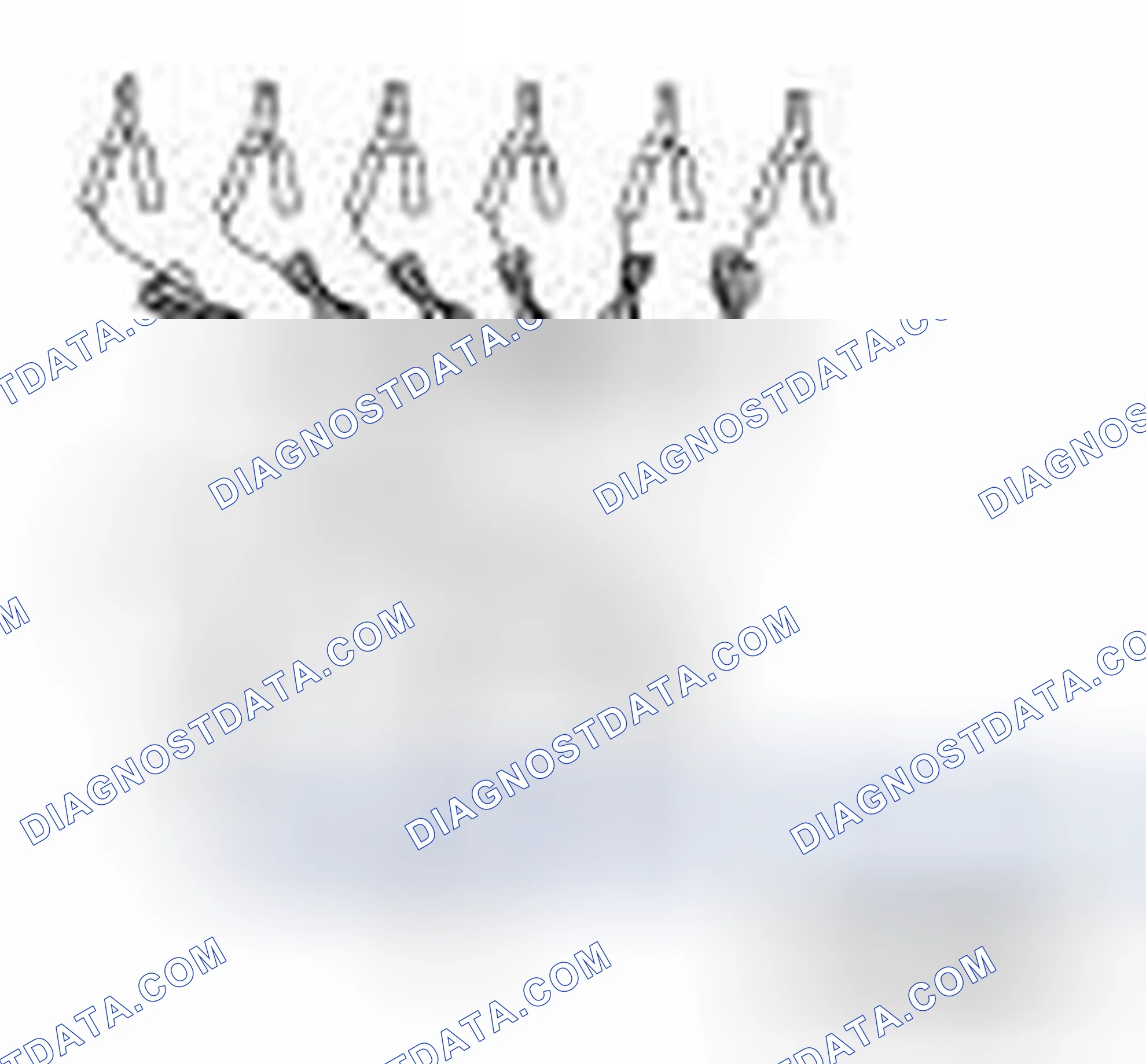 Scheme 118: Special Service Tool