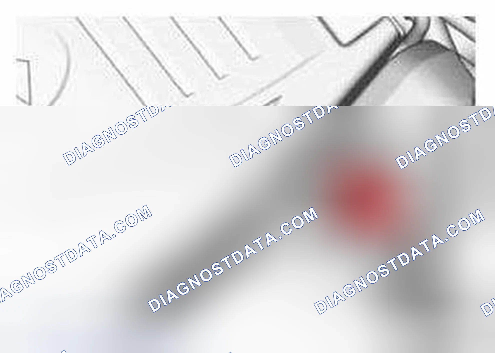 Scheme 36: Removal
