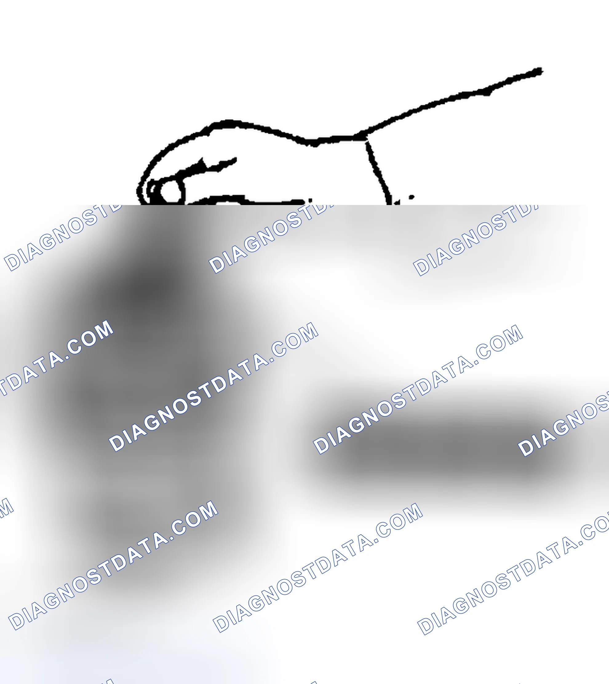 Scheme 100: Pressure Plate Disassembly Note