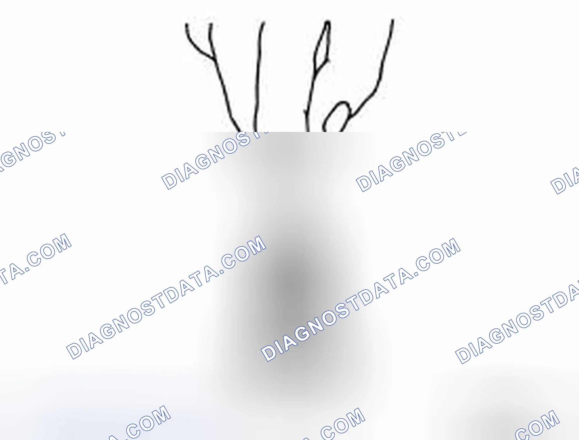 Scheme 301: OIL JET RELIEF VALVE