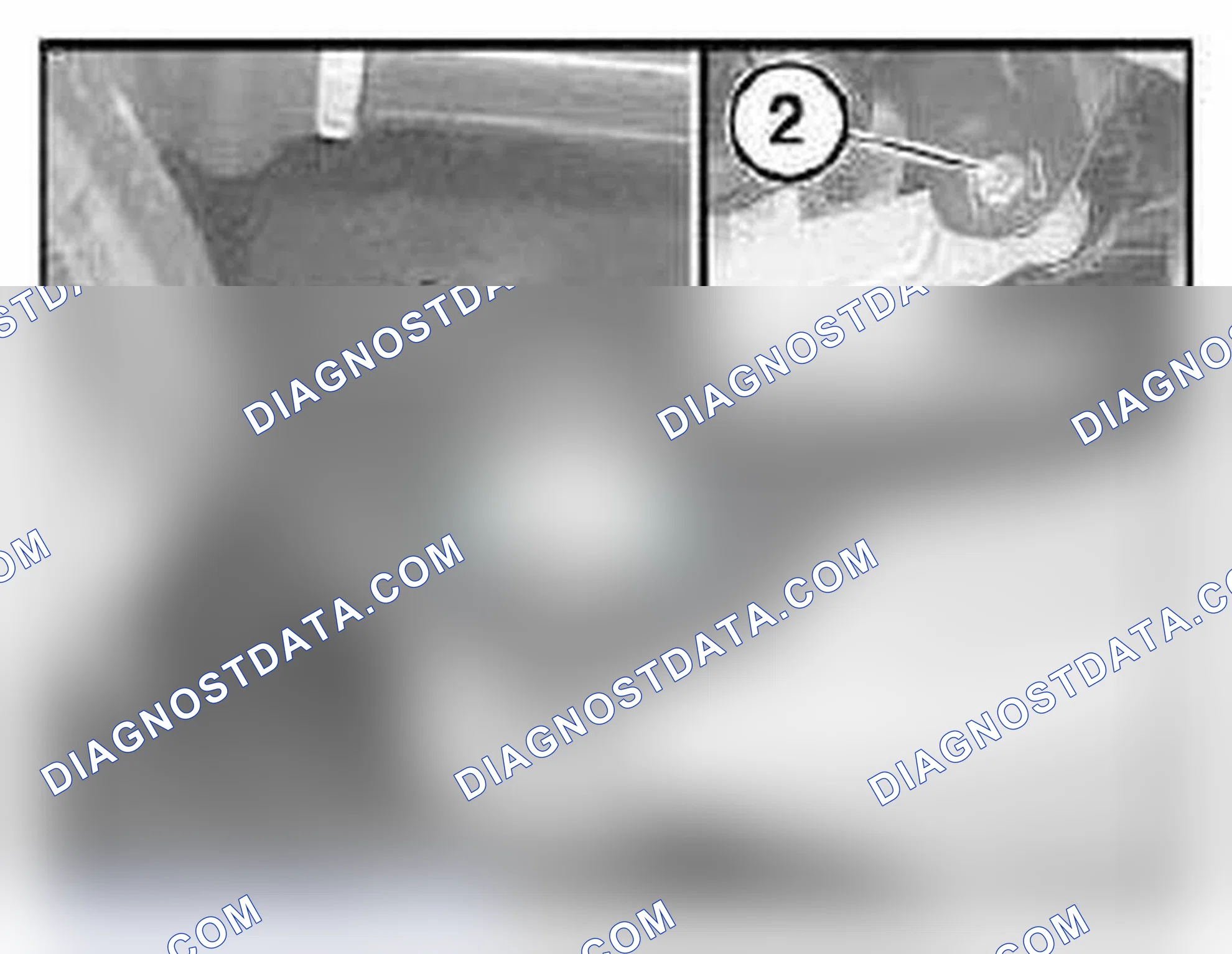 Scheme 23: 32 00 620 ADJUSTING REAR AXLE