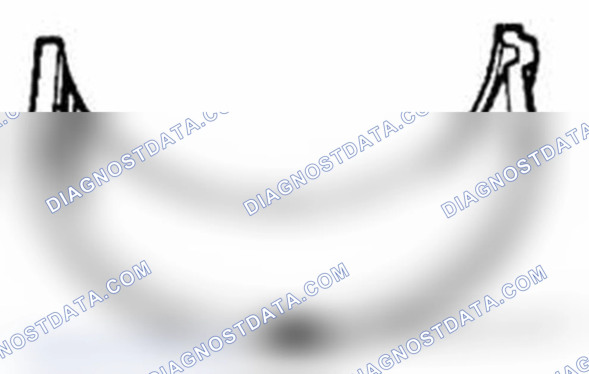 Scheme 170: Connecting Rod Bearing General Information