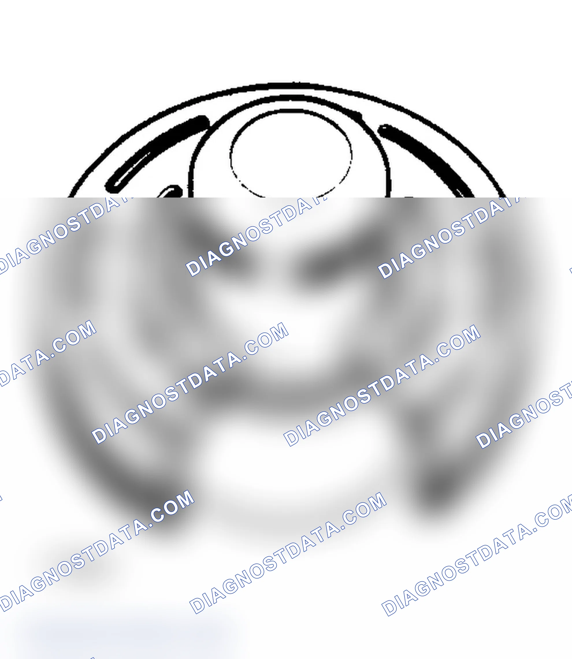 Scheme 29: Remove Bearing