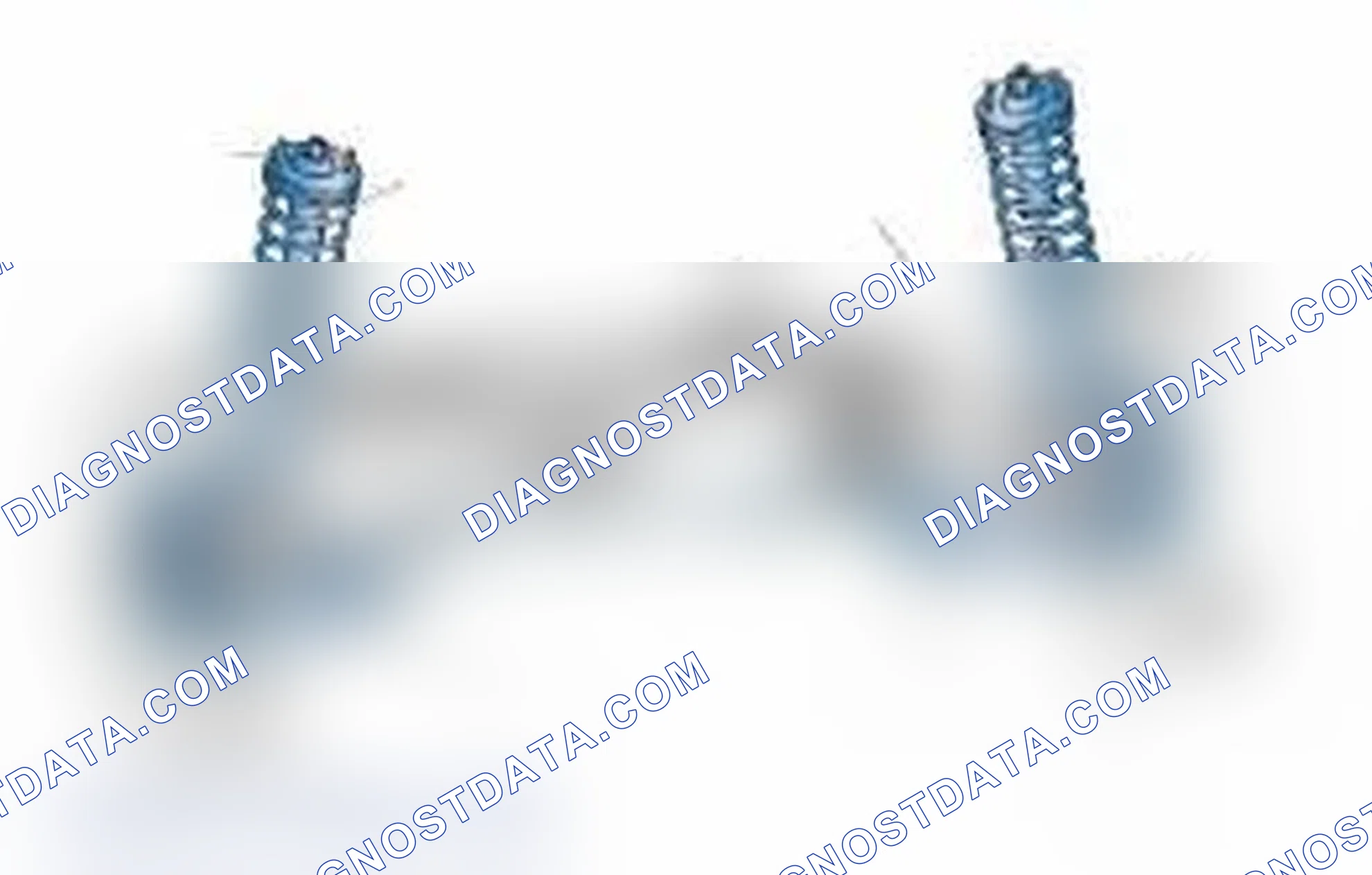 Scheme 25: Typical Front Suspension & Steering Components