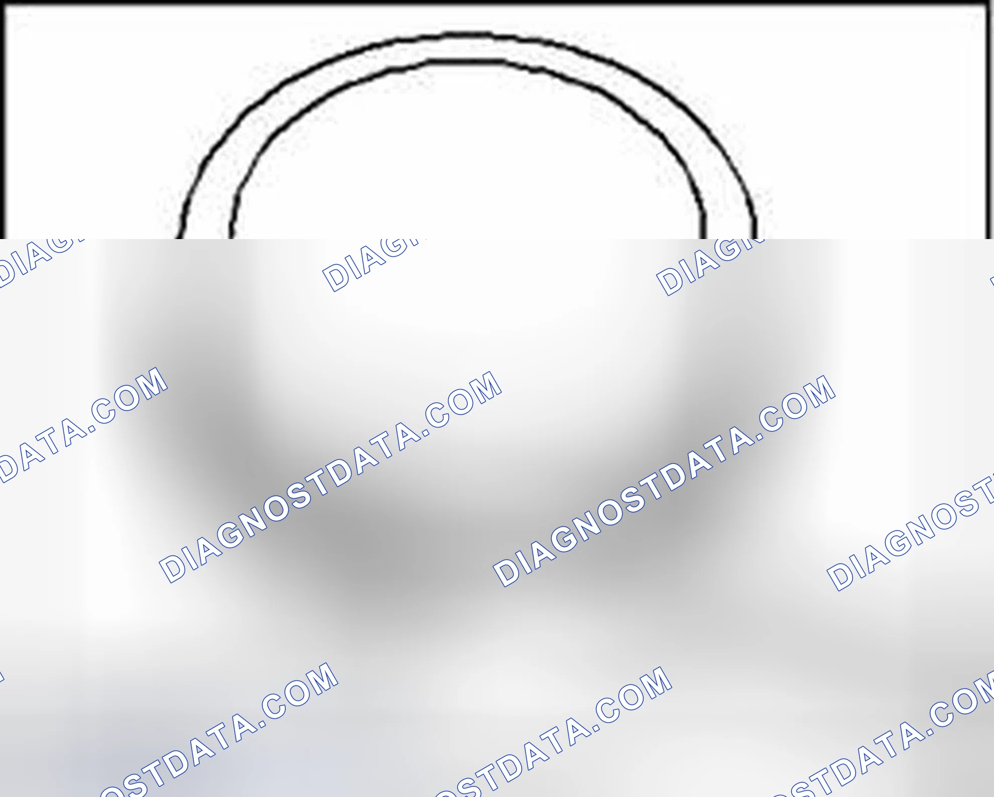 Scheme 11: Measuring piston ring side clearance