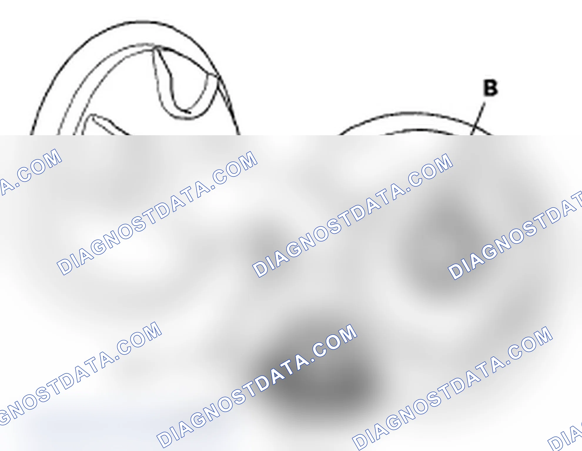 Scheme 41: DTC P0457: EVAP System Leak Detected/Fuel Fill Cap Loose or Missing